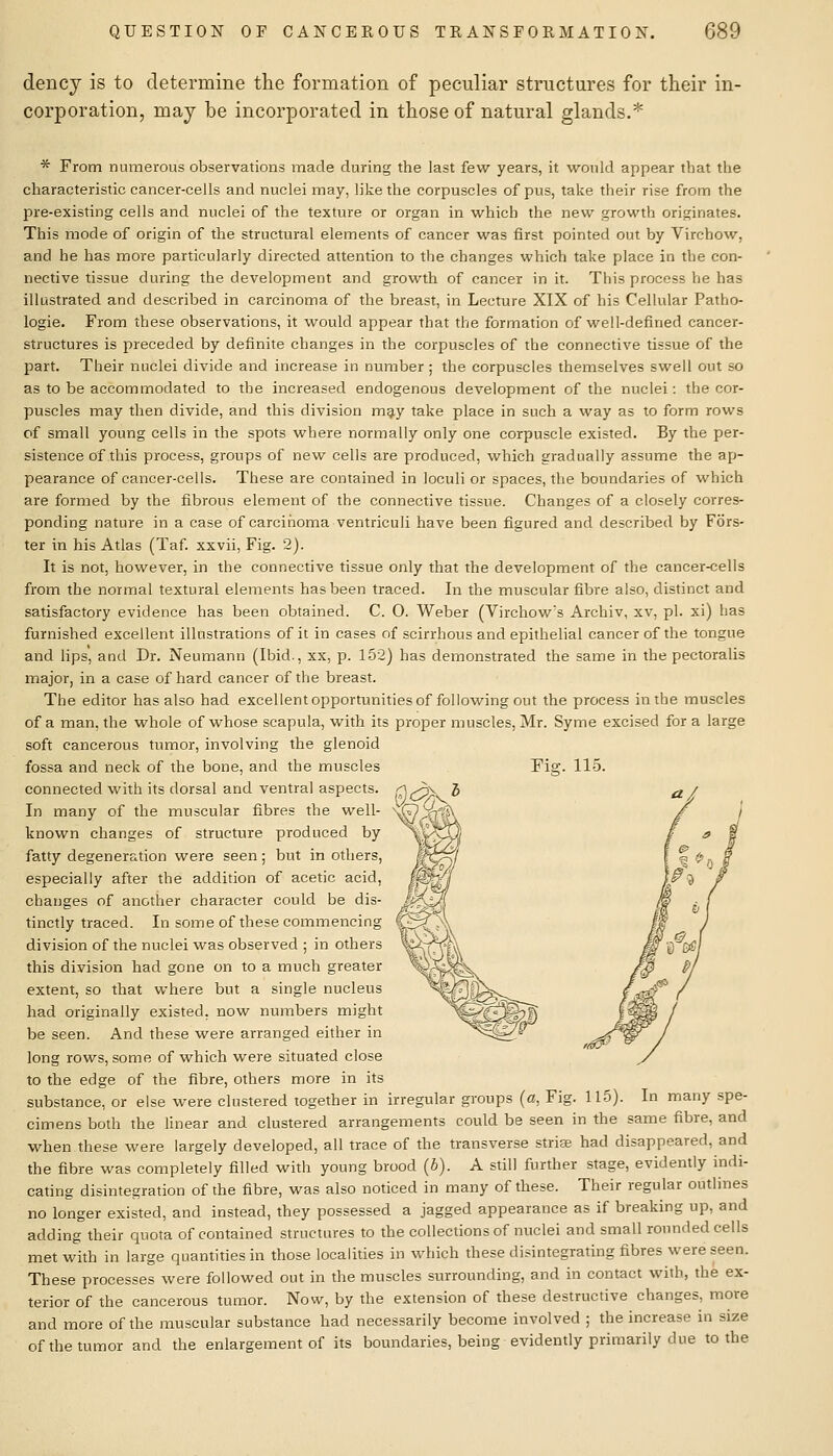 dency is to determine the formation of peculiar structures for their in- corporation, may be incorporated in those of natural glands.* * From numerous observations made during the last few years, it would appear that the characteristic cancer-cells and nuclei may, like the corpuscles of pus, take their rise from the pre-existing cells and nuclei of the texture or organ in which the new growth originates. This mode of origin of the structural elements of cancer was first pointed out by Virchow, and he has more particularly directed attention to the changes which take place in the con- nective tissue during the development and growth of cancer in it. This process he has illustrated and described in carcinoma of the breast, in Lecture XIX of his Cellular Patho- logie. From these observations, it would appear that the formation of well-defined cancer- structures is preceded by definite changes in the corpuscles of the connective tissue of the part. Their nuclei divide and increase in number ; the corpuscles themselves swell out so as to be accommodated to the increased endogenous development of the nuclei: the cor- puscles may then divide, and this division mg.y take place in such a way as to form rows of small young cells in the spots where normally only one corpuscle existed. By the per- sistence of this process, groups of new cells are produced, which gradually assume the ap- pearance of cancer-cells. These are contained in loculi or spaces, the boundaries of which are formed by the fibrous element of the connective tissue. Changes of a closely corres- ponding nature in a case of carcinoma ventriculi have been figured and described by Fors- ter in his Atlas (Taf. xxvii. Fig. 2). It is not, however, in the connective tissue only that the development of the cancer-cells from the normal textural elements has been traced. In the muscular fibre also, distinct and satisfactory evidence has been obtained. C. 0. Weber (Virchow's Archiv, xv, pi. xi) has furnished excellent illustrations of it in cases of scirrhous and epithelial cancer of the tongue and lips, and Dr. Neumann (Ibid., xx, p. 152) has demonstrated the same in the pectoralis major, in a case of hard cancer of the breast. The editor has also had excellentopportunitiesof following out the process in the muscles of a man, the whole of whose scapula, with its proper muscles, Mr. Syme excised for a large soft cancerous tumor, involving the glenoid fossa and neck of the bone, and the muscles Fig. 115. connected with its dorsal and ventral aspects. In many of the muscular fibres the well- known changes of structure produced by fatty degeneration were seen; but in others, especially after the addition of acetic acid, changes of another character could be dis- tinctly traced. In some of these commencing division of the nuclei was observed ; in others this division had gone on to a much greater extent, so that where but a single nucleus had originally existed, now numbers might be seen. And these were arranged either in long rows, some of which were situated close to the edge of the fibre, others more in its substance, or else were clustered together in irregular groups (a, Fig. 115). In many spe- cimens both the linear and clustered arrangements could be seen in the same fibre, and when these were largely developed, all trace of the transverse striae had disappeared, and the fibre was completely filled with young brood (b). A still further stage, evidently indi- cating disintegration of the fibre, was also noticed in many of these. Their regular outlines no longer existed, and instead, they possessed a jagged appearance as if breaking up, and adding their quota of contained structures to the collections of nuclei and small rounded cells met with in large quantities in those localities in which these disintegrating fibres were seen. These processes were followed out in the muscles surrounding, and in contact with, the ex- terior of the cancerous tumor. Now, by the extension of these destructive changes, more and more of the muscular substance had necessarily become involved ; the increase in size of the tumor and the enlargement of its boundaries, being evidently primarily due to the