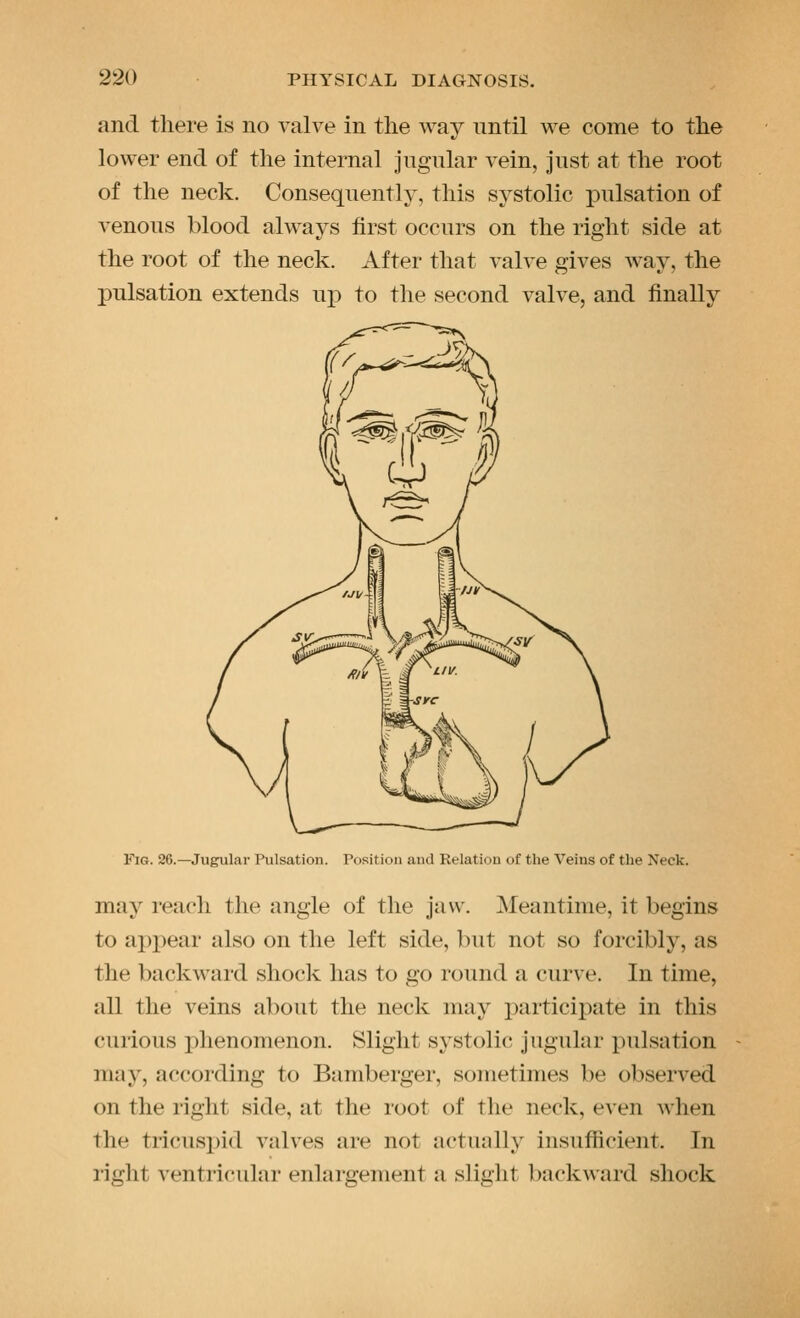 and there is no valve in the way until we come to the lower end of the internal jugular vein, just at the root of the neck. Consequently, this systolic i)ulsation of venous blood always first occurs on the right side at the root of the neck. After that valve gives way, the pulsation extends up to the second valve, and finally Fig. 26.—Jugular Pulsation. Position and Relation of the Veins of the Neck. may reach the angle of the jaw. Meantime, it begins to apj)ear also on the left side, but not so forcibly, as the backward shock has to go round a curve. In time, all the veins about the neck may participate in this curious phenomenon. Slight systolic jugular pulsation may, according to Bamberger, sometimes be observed on the right side, at the root of the neck, even when the tricusxjid valves are not actually insufficient. In right ventricular enlargement a slight backward shock