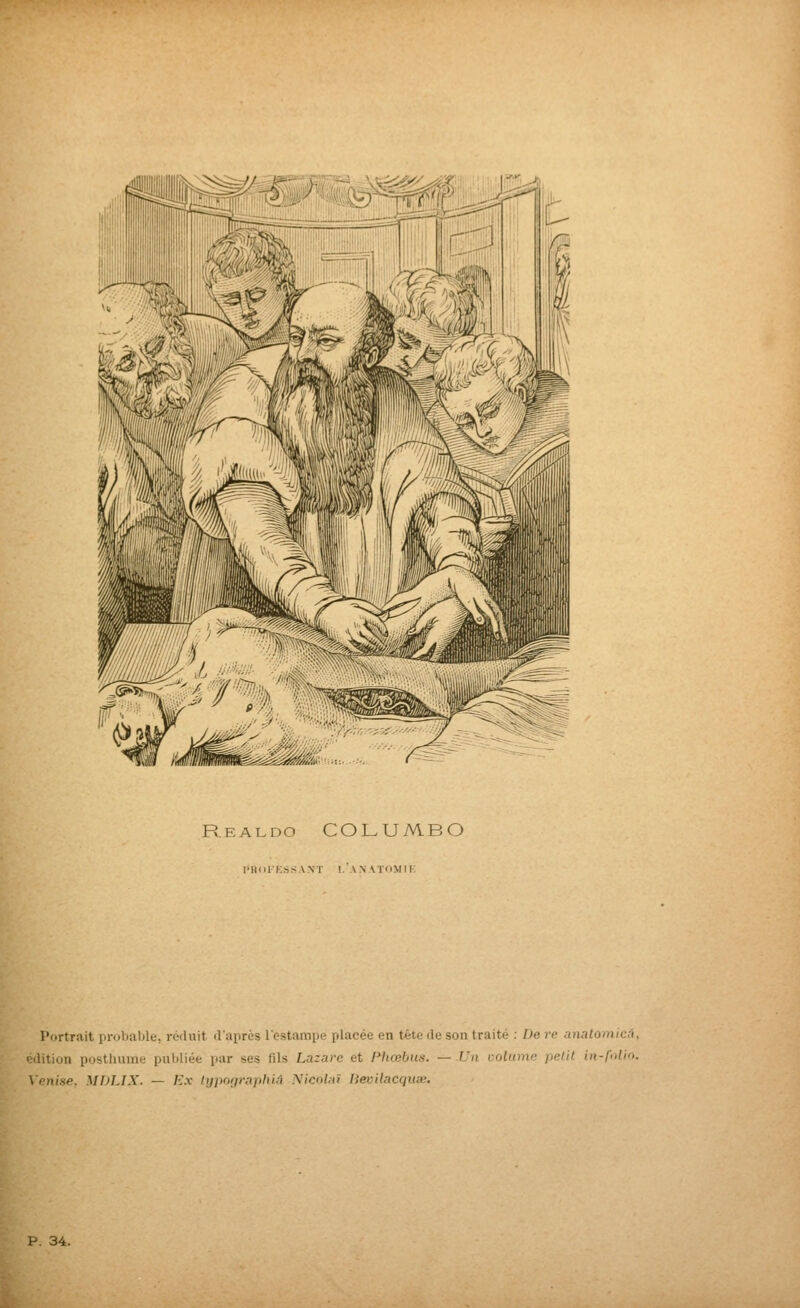 m Realdo COLUMBO IMKHKSSANT !. ANATOMIK Portrait proliable, réduit d'après l'estampe placée en tête de son traité : De rc anatomiai, ' dition posthume publiée par ses fils Lazare et Phœbus. — Un volume petit in-folio. Venise. MDTJX. — Ex typnriraphiâ NicnlHï lievilacquœ.