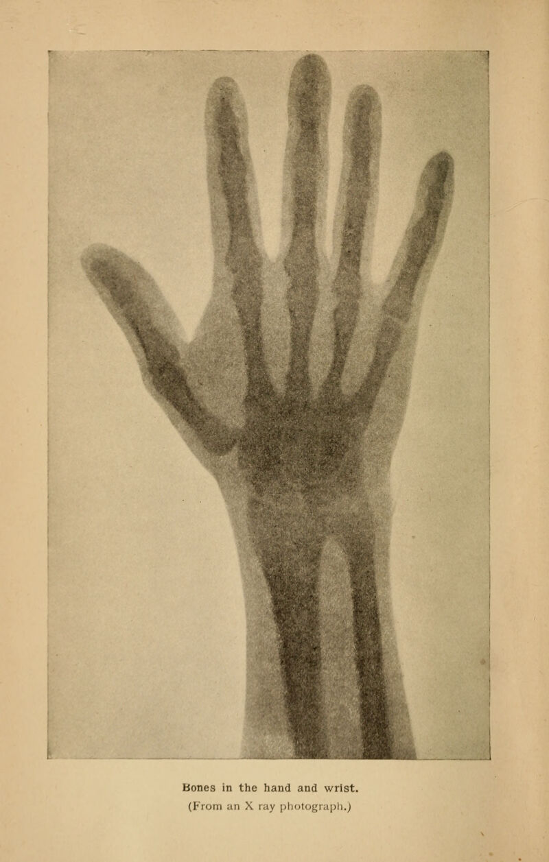 Bones in the hand and wrist. (From an X ray [jhotograiJli.J