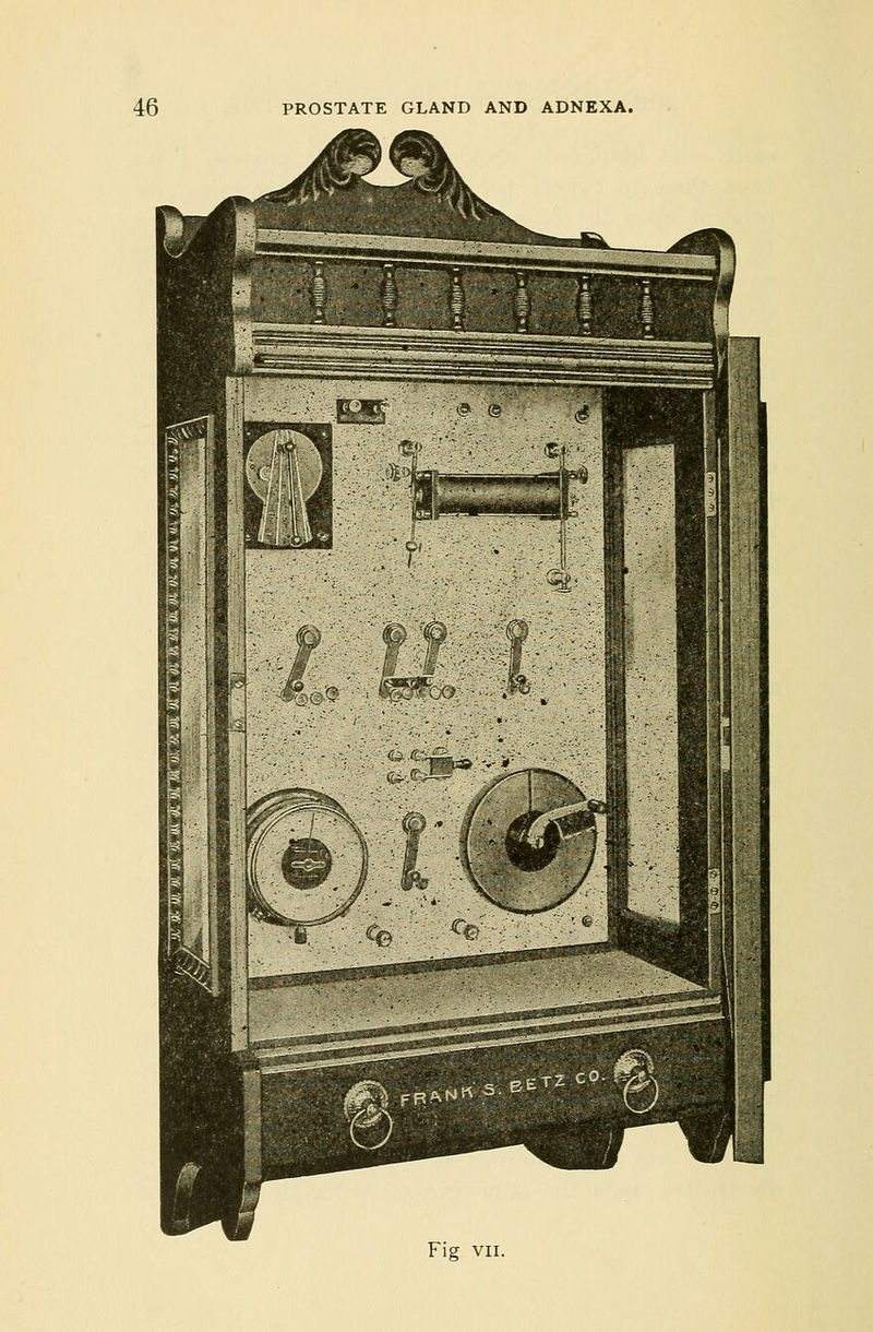 No text description is available for this image