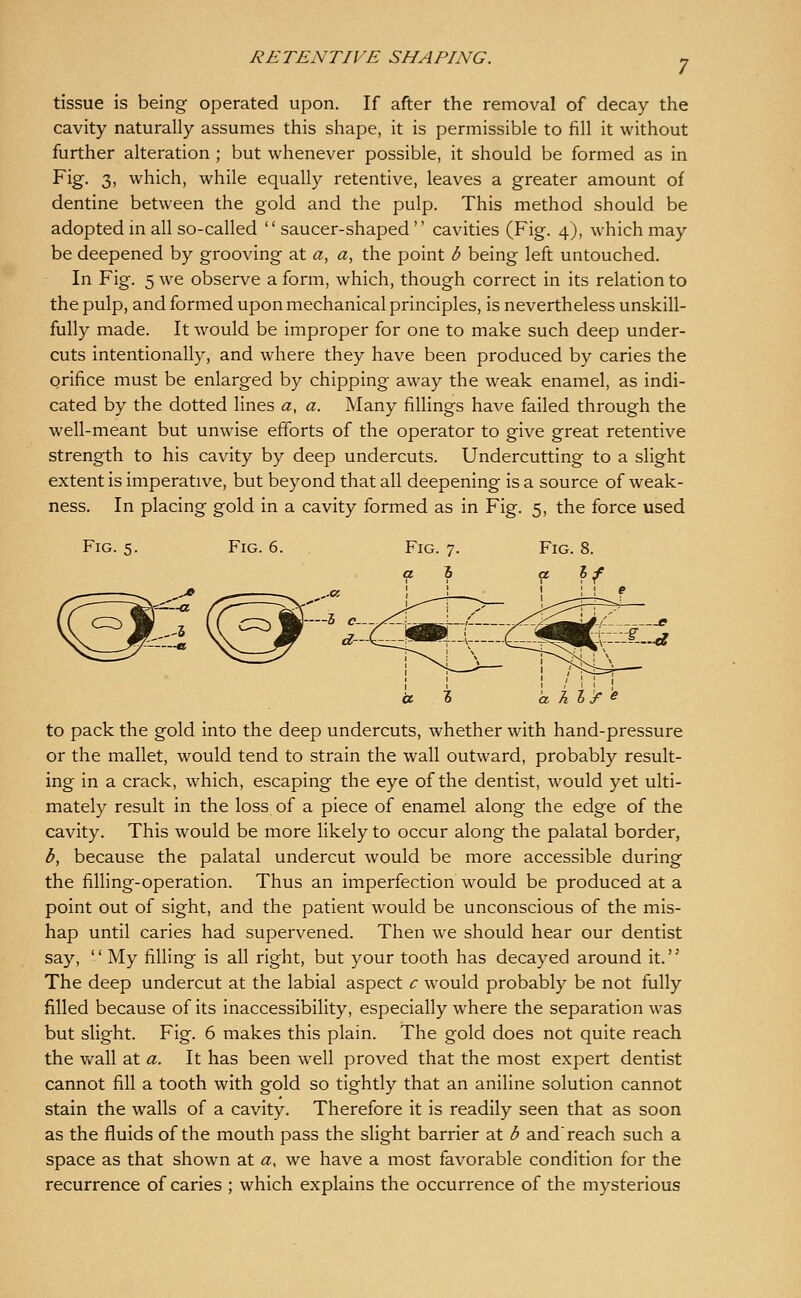 tissue is being operated upon. If after the removal of decay the cavity naturally assumes this shape, it is permissible to fill it without further alteration ; but whenever possible, it should be formed as in Fig. 3, which, while equally retentive, leaves a greater amount of dentine between the gold and the pulp. This method should be adopted in all so-called saucer-shaped cavities (Fig. 4), which may be deepened by grooving at a, a, the point b being left untouched. In Fig. 5 we observe a form, which, though correct in its relation to the pulp, and formed upon mechanical principles, is nevertheless unskill- fully made. It would be improper for one to make such deep under- cuts intentionally, and where they have been produced by caries the orifice must be enlarged by chipping away the weak enamel, as indi- cated by the dotted lines a, a. Many fillings have failed through the well-meant but unwise efforts of the operator to give great retentive strength to his cavity by deep undercuts. Undercutting to a slight extent is imperative, but beyond that all deepening is a source of weak- ness. In placing gold in a cavity formed as in Fig. 5, the force used Fig. 5. Fig. 6. —5 d- a hl£ e to pack the gold into the deep undercuts, whether with hand-pressure or the mallet, would tend to strain the wall outward, probably result- ing in a crack, which, escaping the eye of the dentist, would yet ulti- mately result in the loss of a piece of enamel along the edge of the cavity. This would be more likely to occur along the palatal border, b, because the palatal undercut would be more accessible during the filling-operation. Thus an imperfection would be produced at a point out of sight, and the patient would be unconscious of the mis- hap until caries had supervened. Then we should hear our dentist say, My filling is all right, but your tooth has decayed around it.'' The deep undercut at the labial aspect c would probably be not fully filled because of its inaccessibility, especially where the separation was but slight. Fig. 6 makes this plain. The gold does not quite reach the v/all at a. It has been well proved that the most expert dentist cannot fill a tooth with gold so tightly that an aniline solution cannot stain the walls of a cavity. Therefore it is readily seen that as soon as the fluids of the mouth pass the slight barrier at b and reach such a space as that shown at a, we have a most favorable condition for the recurrence of caries ; which explains the occurrence of the mysterious