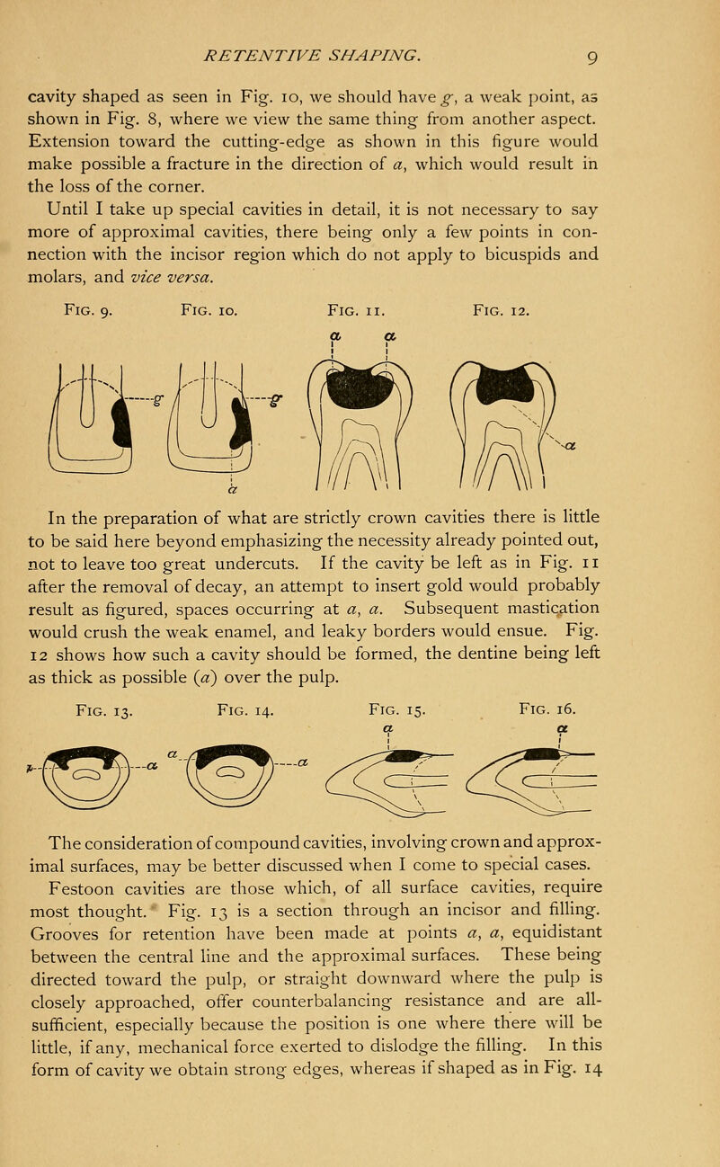 cavity shaped as seen in Fig. lo, we should have g, a weak point, as shown in Fig. 8, where we view the same thing from another aspect. Extension toward the cutting-edge as shown in this figure would make possible a fiacture in the direction of a, which would result in the loss of the corner. Until I take up special cavities in detail, it is not necessary to say more of approximal cavities, there being only a few points in con- nection with the incisor region which do not apply to bicuspids and molars, and vice versa. Fig. 9. Fig. 10. Fig. 12. In the preparation of what are strictly crown cavities there is little to be said here beyond emphasizing the necessity already pointed out, not to leave too great undercuts. If the cavity be left as in Fig. 11 after the removal of decay, an attempt to insert gold would probably result as figured, spaces occurring at a, a. Subsequent mastication would crush the weak enamel, and leaky borders would ensue. Fig. 12 shows how such a cavity should be formed, the dentine being left as thick as possible {a) over the pulp. Fig. 13. Fig. 14. Fig. 15 The consideration of compound cavities, involving crown and approx- imal surfaces, may be better discussed when I come to special cases. Festoon cavities are those which, of all surface cavities, require most thought.' Fig. 13 is a section through an incisor and filUng. Grooves for retention have been made at points a, a, equidistant between the central line and the approximal surfaces. These being directed toward the pulp, or straight downward where the pulp is closely approached, offer counterbalancing resistance and are all- sufficient, especially because the position is one where there will be little, if any, mechanical force exerted to dislodge the filling. In this form of cavity we obtain strong edges, whereas if shaped as in Fig. 14