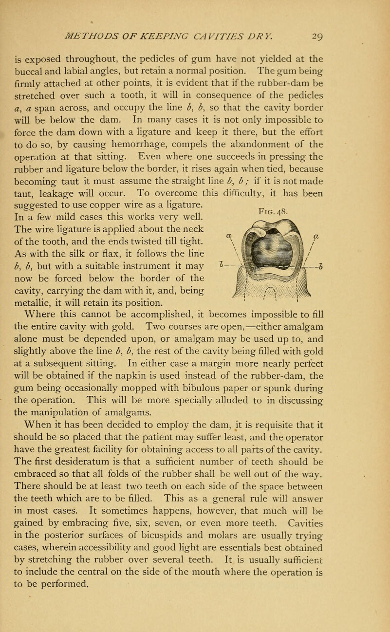 is exposed throughout, the pedicles of gum have not yielded at the buccal and labial angles, but retain a normal position. The gum being firmly attached at other points, it is evident that if the rubber-dam be stretched over such a tooth, it will in consequence of the pedicles a, a span across, and occupy the line b, b, so that the cavity border will be below the dam. In many cases it is not only impossible to force the dam down with a ligature and keep it there, but the effort to do so, by causing hemorrhage, compels the abandonment of the operation at that sitting. Even where one succeeds in pressing the rubber and ligature below the border, it rises again when tied, because becoming taut it must assume the straight line b, b ; if it is not made taut, leakage will occur. To overcome this difficulty, it has been suggested to use copper wire as a ligature. In a few mild cases this works very well. The wire ligature is applied about the neck of the tooth, and the ends twisted till tight. As with the silk or flax, it follows the line b, b, but with a suitable instrument it may ^—-'-^ now be forced below the border of the cavity, carrying the dam with it, and, being metallic, it will retain its position. ' Where this cannot be accomplished, it becomes impossible to fill the entire cavity with gold. Two courses are open,—either amalgam alone must be depended upon, or amalgam may be used up to, and slightly above the line b, b, the rest of the cavity being filled with gold at a subsequent sitting. In either case a margin more nearly perfect will be obtained if the napkin is used instead of the rubber-dam, the gum being occasionally mopped with bibulous paper or spunk during the operation. This will be more specially alluded to in discussing the manipulation of amalgams. When it has been decided to employ the dam, it is requisite that it should be so placed that the patient may suffer least, and the operator have the greatest facility for obtaining access to all pai-ts of the cavity. The first desideratum is that a sufficient number of teeth should be embraced so that all folds of the rubber shall be well out of the way. There should be at least two teeth on each side of the space between the teeth which are to be filled. This as a general rule will answer in most cases. It sometimes happens, however, that much will be gained by embracing five, six, seven, or even more teeth. Ca\-ities in the posterior surfaces of bicuspids and molars are usually trying cases, wherein accessibility and good light are essentials best obtained by stretching the rubber over several teeth. It is usually sufficient to include the central on the side of the mouth where the operation is to be performed.