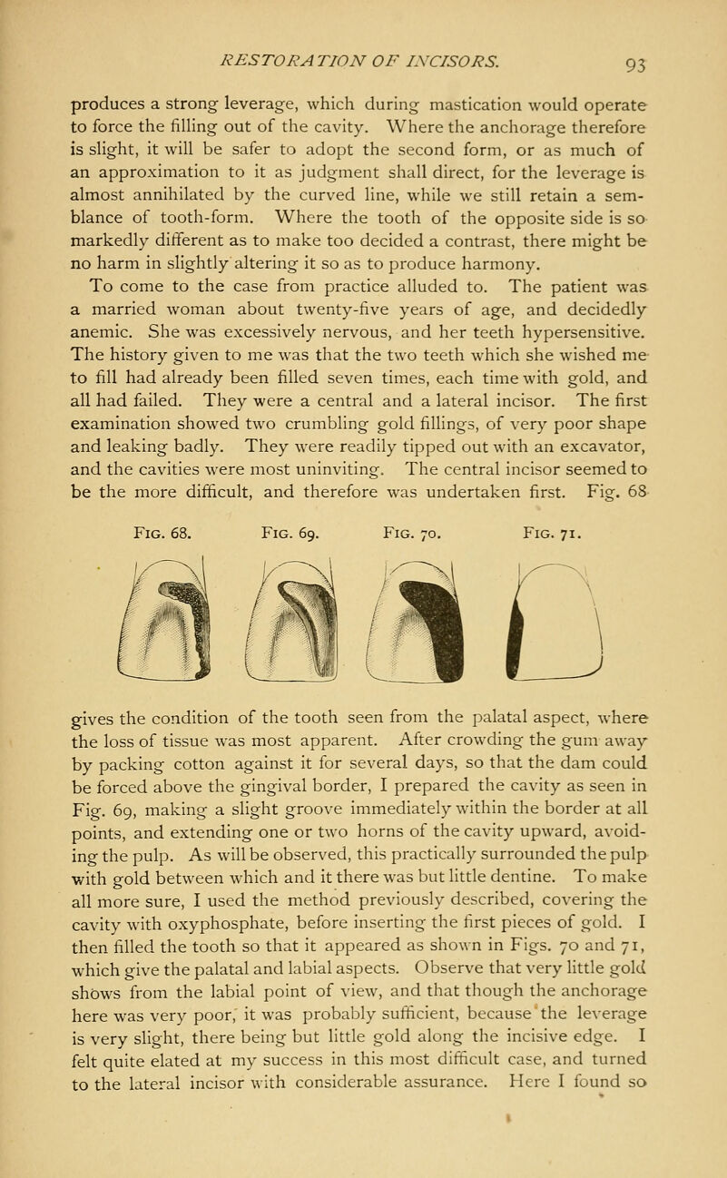 RESTORA TION OF INCISORS. 9? produces a strong leverage, which during mastication would operate to force the filling out of the cavity. Where the anchorage therefore is slight, it will be safer to adopt the second form, or as much of an approximation to it as judgment shall direct, for the leverage is almost annihilated by the curved line, while we still retain a sem- blance of tooth-form. Where the tooth of the opposite side is so markedly ditferent as to make too decided a contrast, there might be no harm in slightly altering it so as to produce harmony. To come to the case from practice alluded to. The patient was a married woman about twenty-five years of age, and decidedly anemic. She was excessively nervous, and her teeth hypersensitive. The history given to me was that the two teeth which she wished me- to fill had already been filled seven times, each time with gold, and all had failed. They were a central and a lateral incisor. The first examination showed two crumbling gold fillings, of very poor shape and leaking badly. They were readily tipped out with an excavator, and the cavities were most uninviting. The central incisor seemed to be the more difficult, and therefore was undertaken first. Fig. 68 Fig. 68. Fig. 69. Fig. 70. Fig. 71. gives the condition of the tooth seen from the palatal aspect, where the loss of tissue was most apparent. After crowding the gum away by packing cotton against it for several days, so that the dam could be forced above the gingival border, I prepared the cavity as seen in Fig. 69, making a slight groove immediately within the border at all points, and extending one or two horns of the cavity upward, avoid- ing the pulp. As will be observed, this practically surrounded the pulp with gold between which and it there was but little dentine. To make all more sure, I used the method previously described, covering the cavity with oxyphosphate, before inserting the first pieces of gold. I then filled the tooth so that it appeared as shown in Figs. 70 and 71, which give the palatal and labial aspects. Observe that very little gold shows from the labial point of view, and that though the anchorage here was very poor,' it was probably sufficient, because'the leverage is very slight, there being but little gold along the incisive edge. I felt quite elated at my success in this most difficult case, and turned to the lateral incisor with considerable assurance. Here I found so