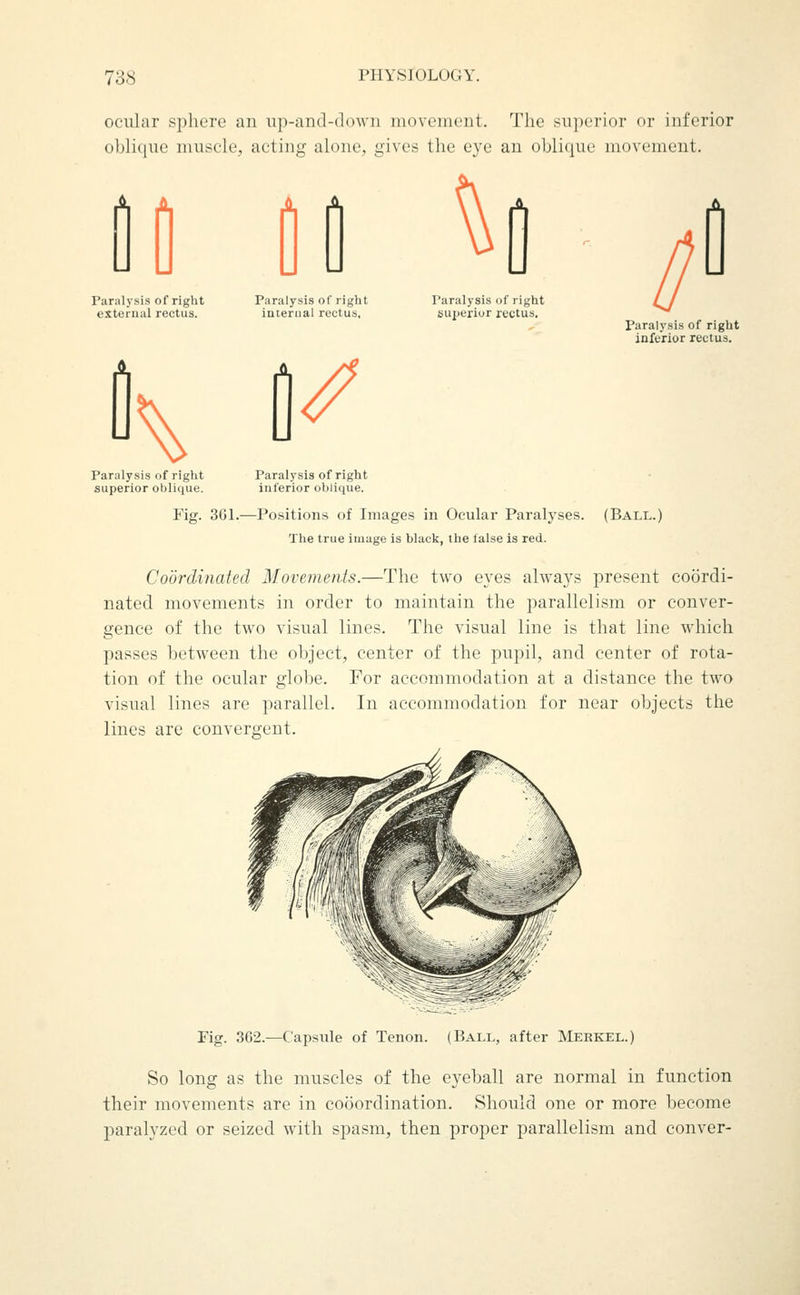 ocular sphere an up-and-down movement. The superior or inferior oblique muscle, acting alone, gives the eye an oblique movement. A X Paralysis of right external rectus. Paralysis of right iateriial rectus. Paralysis of right sujierior rectus. / Paralysis of right inferior rectus. Paralysis of right superior oblique. Paralysis of right inferior oblique. Fig. 301.—Positions of Images in Ocular Paralyses. (Ball.) The true image is black, the false is red. Coordinated Movements.—The two eyes always present coordi- nated movements in order to maintain the parallelism or conver- gence of the two visual lines. The visual line is that line which passes between the object, center of the pupil, and center of rota- tion of the ocular glolje. For accommodation at a distance the two visual lines are parallel. In accommodation for near objects the lines are convergent. Pig. 3G2.—Capsule of Tenon. (Ball, after Merkel.) So long as the muscles of the eyeball are normal in function their movements are in cooordination. Should one or more become paralyzed or seized with spasm, then proper parallelism and conver-