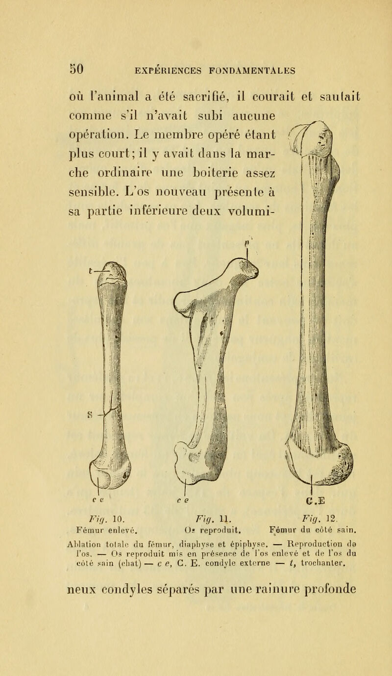où l'animal a été sacrifié, il courait et sautait comme s'il n'avait subi aucune opération. Le membre opéré étant plus court; il y avait dans la mar- che ordinaire une boiterie assez sensible. L'os nouveau présente à sa partie inférieure deux volumi- ■\'ï M CE Fig. 10. Fifj. 11. Fig'. 12. Fémur enlevé. Os reproduit. Fémur du côté sain. Alilntion totale du fémur, diapliyse et épiphyse. — Reproduction do l'os. — Os reproduit mis en présence de l'os enlevé et de l'os du côlé sain (chat)— c e, C. E. condyle externe — t, troclianler. neux condyles séparés par une rainure profonde