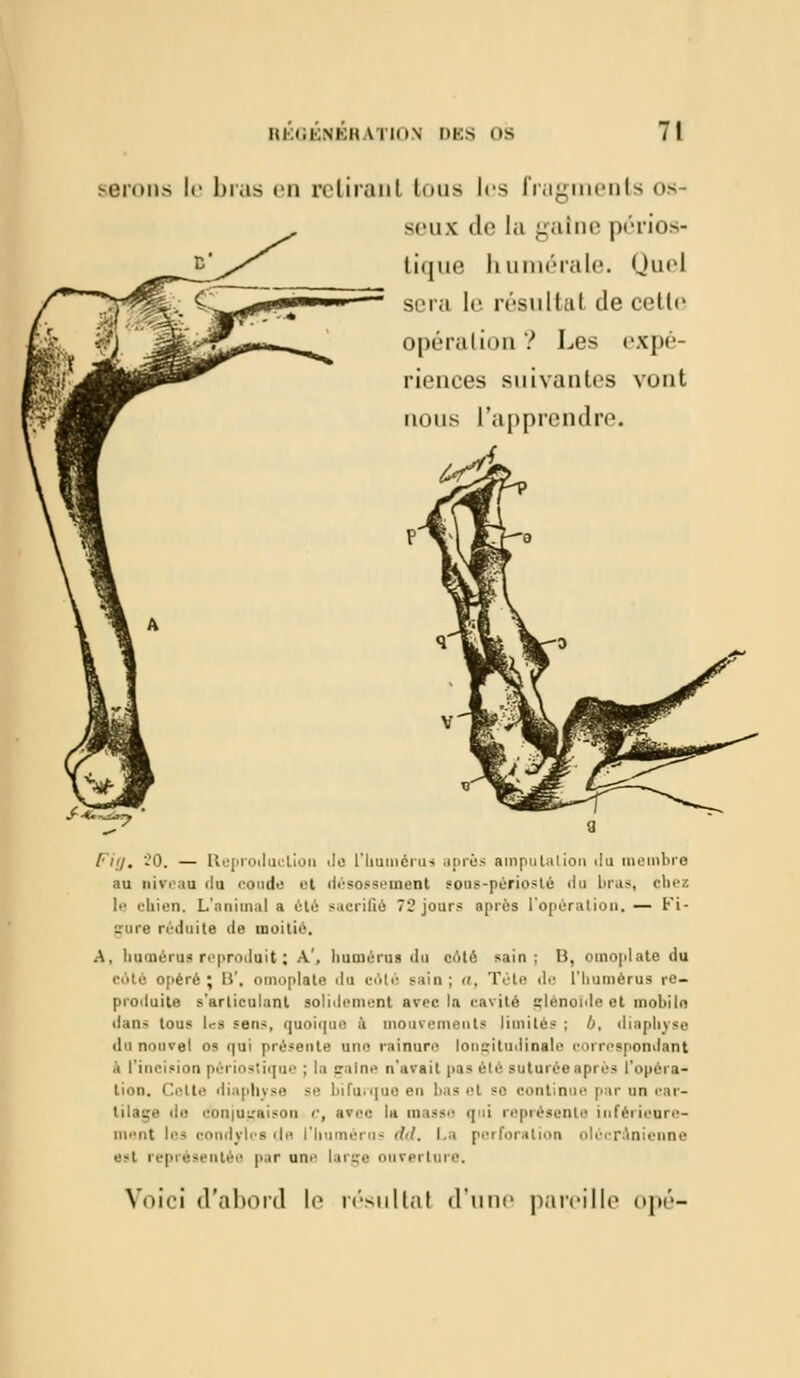 serons le bras en retirant tous les fragments os- seux de la gaine périos- tique humérale. Quel sera le résultat de celle opérai ion ? Les expé- riences suivantes vont nous rapprendre. Fig, 20. — Reproduction île l'humérus après amputation ilu membre au iiiv.au ilu coude et désossement sous-périosté du bras, chez le chien. L'animal a été sacrifié 72 jours après l'opération. — fi- gure réduite de moitié. A. bamérua reproduit ; A', humérus du côté sain; B, omoplate du opéré; IV. omoplate du col.' sain; . Tôle de l'humérus re- produite s'arliculant solidement avec la cavité çlénoide et mobiln dans tous les sens, quoique à mouvements limites ; h, diapbyse du nouvel os qui présente une rainure lonsitiidinali* correspondant à l'incision périostique ; la gaine n'avait pas été suturée après l'opéra- tion. Celte diaphyse se bifurque en bas el se continue par un car- injugaison '■, a?eo la masse qui représente inférieure- ment les condyles de l'humérus dd. La perforation olécrénienne est représentée par uni' large ouverture. Voici d'abord le résultat d'une pareille opé-