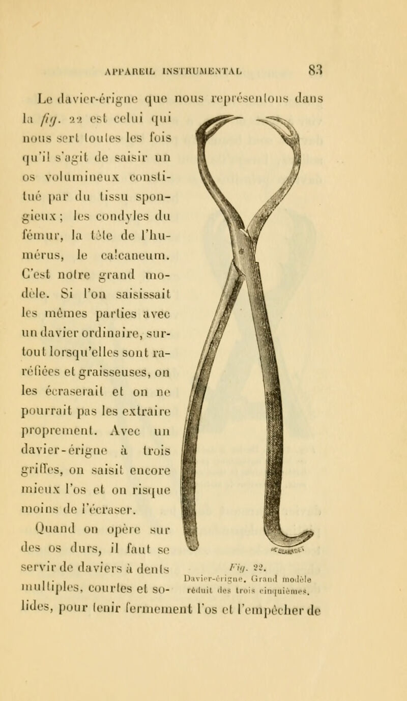 Le davier-érigne que nous représentons dans La //'//. ■>■>. esl celui qui lions si'ri loutes les lois qu'il s'agit il»1 saisir un us volumineux consti- lué pat du tissu spon- gieux : les condyles du fémur, la l 'li' de L'hu- mérus, le calcaneum. C'est notre grand nio- dèle. Si Ton saisissait les mêmes parties avec un davier ordinaire, sur- tout lorsqu'elles sont ra- réfiées et graisseuses, on les écraserait et on ne pourrait pas les extraire proprement. Avec un davier-érigne à trois griffes, on saisit encore mieux l'os et on risque moins de l'écraser. Quand oo opère sur des os durs, il faut se servir de daviers à dénis £iuen<-* lu,. 88, 1U\ ier-éi igné. < irand (nodule multiples, courtes et su- réduit ries ti trni* cinquièmes lid. pour tenir fermement l'os el l'empêcher de