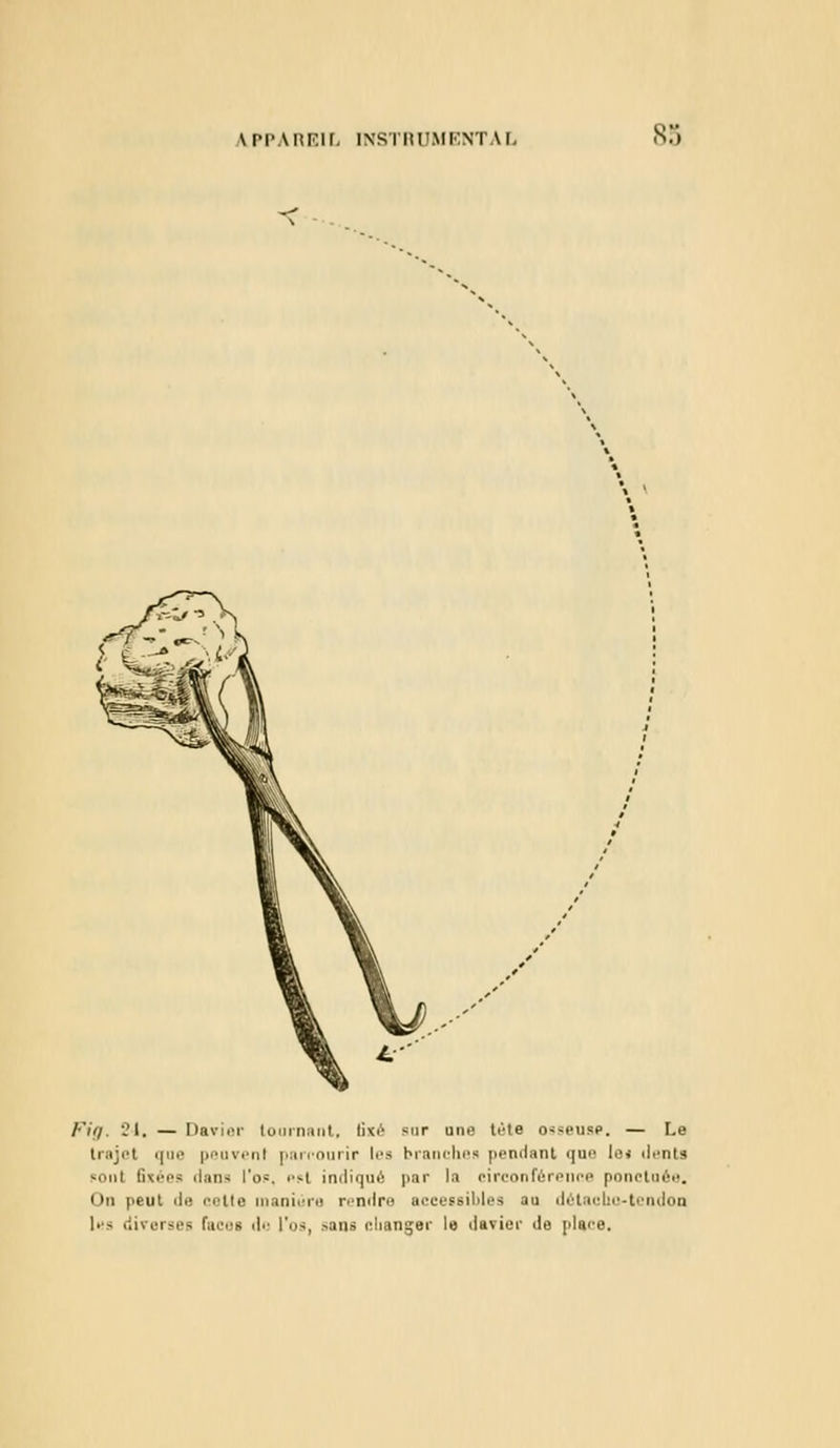 s:; Fig. 24, — Davier tournant, lixe sur une tète osseuse. — Le trajet que peuvenl parcourir lea branche» pendant <\w lo* ilcnta sont fixées dans l'os, psI indiqué par la circonférence ponctuée. On peut de celte manière rendre accessibles au détaclio-tcndon lea diverses fai'.'s de l'os, ^ans changer le davier de place.