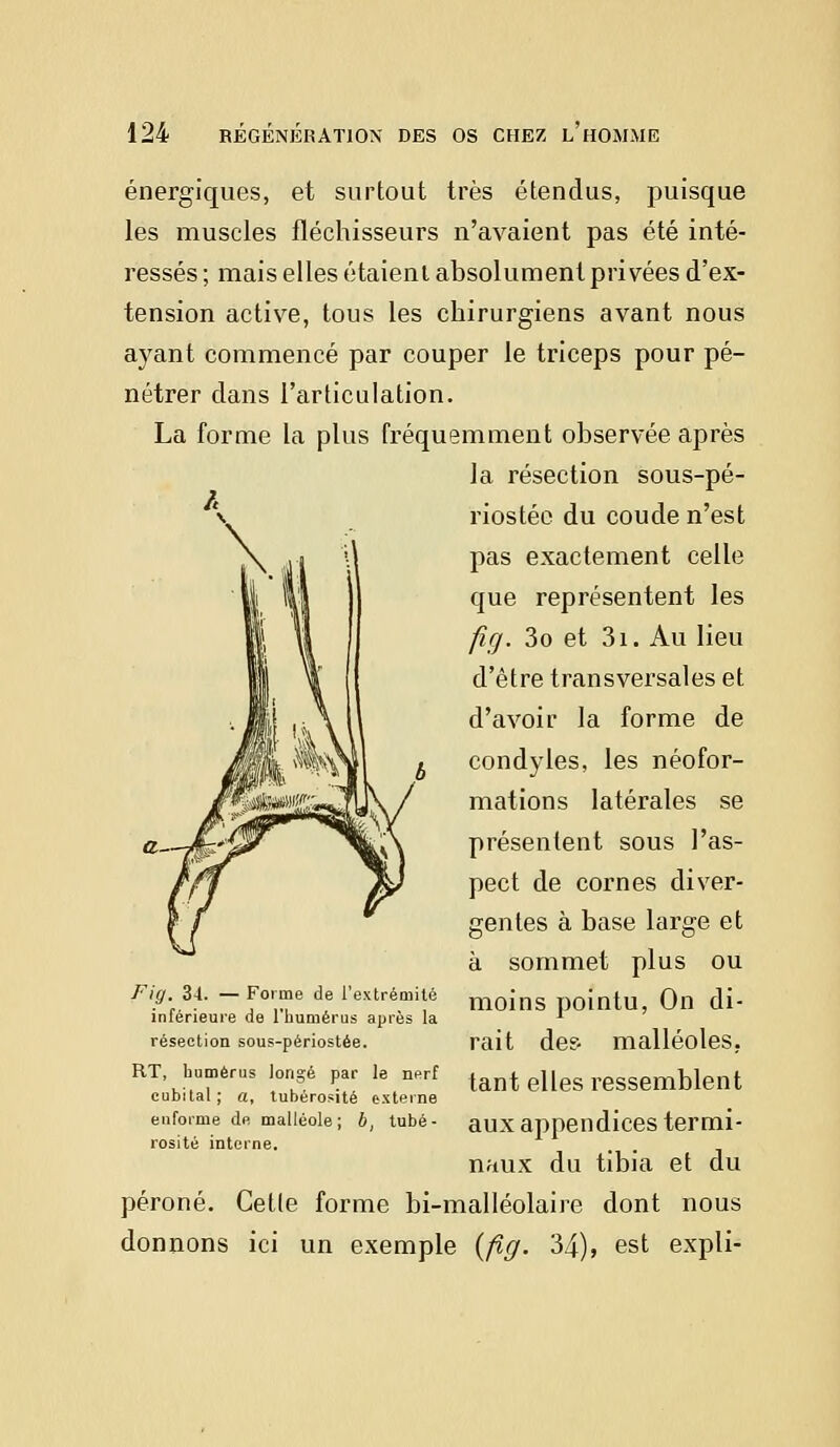 énergiques, et surtout très étendus, puisque les muscles fléchisseurs n'avaient pas été inté- ressés ; mais elles étaient absolument privées d'ex- tension active, tous les chirurgiens avant nous ayant commencé par couper le triceps pour pé- nétrer clans l'articulation. La forme la plus fréquemment observée après la résection sous-pé- riostée du coude n'est pas exactement celle que représentent les fig. 3o et 3i. Au lieu d'être transversales et d'avoir la forme de condyles, les néofor- mations latérales se présentent sous l'as- pect de cornes diver- gentes à base large et à sommet plus ou moins pointu, On di- rait des malléoles, tant elles ressemblent aux appendices termi- naux du tibia et du péroné. Cette forme bi-malléolaire dont nous donnons ici un exemple {fig. 34), est expli- Fig. 34. — Forme de l'extrémité inférieure de l'humérus après la résection sous-périostée. RT, humérus longé par le nerf cubital; a, tubérosité externe enfariné de malléole; b, tubé- rosité interne.