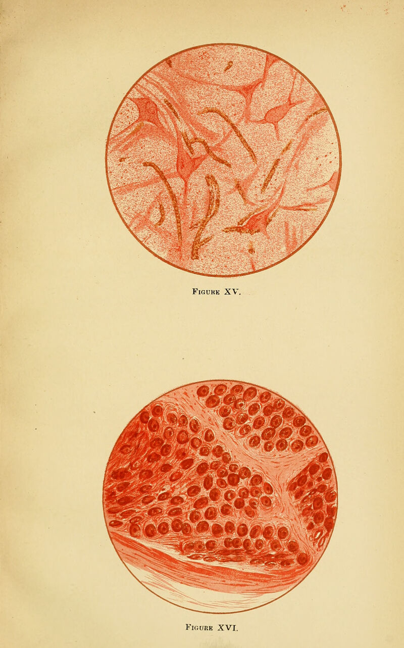 Figure XV. Figure XVI.