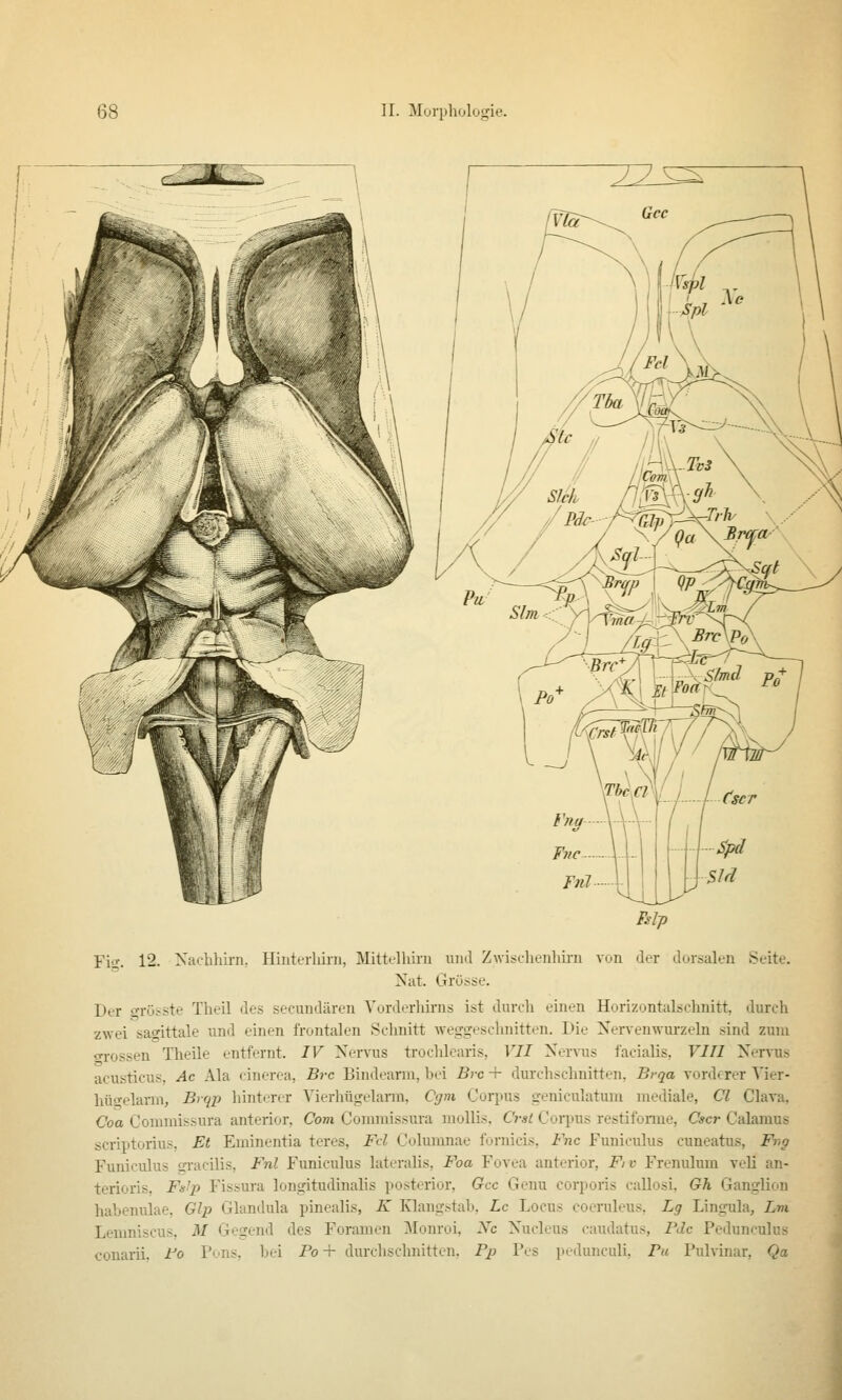 Fiir 12. Xacbliirn. Hinterliini, Mittelhiru und Zwisclieulm-n von der dorsalen Seite. Nat. Grösse. Der oTösste Theil des secundären Vorderhirns ist durch einen Horizontalschnitt, durch zwei sao-ittale und einen frontalen Sclmitt weggeschnitten. Die Nervenwurzeln sind zum o-rossen Theile entfernt. IV Nervus trochlearis, VII Nervus facialis, VIH Nervus acusticus, Ac Ala cinerea, Bi-c Bindeann, hei Brc + durchschnitten, Brqa vorderer Vier- hüffelarm, Brqp lauterer Vierhügelann, Cgm Corpus geniculatum mediale, Cl Clava. Coa Conirnissura anterior. Com Commissura mollis, Crsl Corpus restifonue, Cscr Calamus scriptorius. Et Eininentia teres, Fd Columnae fornicis, Fnc Funiculus cuneatus, Fnp Funiculus gi-acilis, Fnl Funiculus lateralis, Foa Fovea anterior, Fiv Frenulum veli an- terioris, Fulp Fissura longitudinalis posterior, Gcc Genu corporis callosi. Gh Ganglion habenulae, Glp Glandula pinealis, K Klangstah, Lc Locus coeruleus, Lg Lingula, Lm Lemniscus. M Gegend des Foramen Monroi, Xc Nucleus caudatus, Pdc Pedunculus conarii. I'o Pons, hei Fo + durchschnitten. P/j Pes pedunculi. Pa Pulvinar, Qa