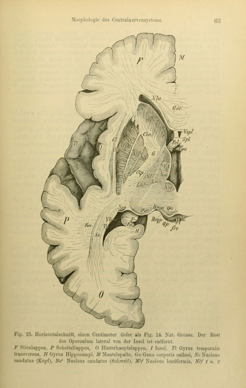 15. Horizontalsehnitt, eines Centimeter liefer als Pig. 14. Nat. Grosse. Der Kest Opercnloni Lateral von der Insel ist entfernt, olappen, P Bcheitellappen, 0 Einterbanptslappen, / [nsel, Tt Gyrus temporaüe errat, ZTGyrai Hippocampi, M Mantelipalte, (TuGenu corporis callosi, WcNuoleus eaudatua (Köpf), AV Nnclena caudatus (Sehweif)) Wf Nucleus lentiformu, Nif i u