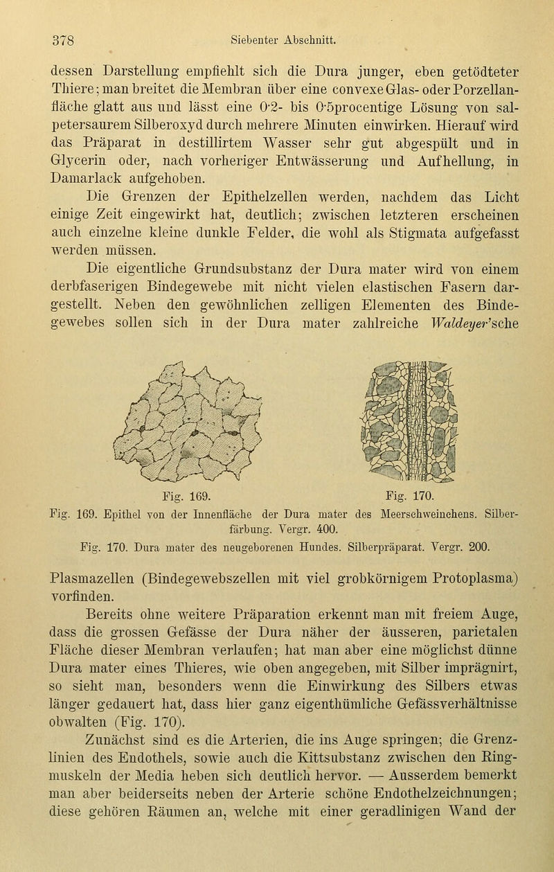 dessen Darstellung empfiehlt sich die Dura junger, eben getödteter Thiere; man breitet die Membran über eine convexe Glas-oder Porzellan- fläche glatt aus und lässt eine 02- bis Oöprocentige Lösung von sal- petersaurem Silberoxyd durch mehrere Minuten einwirken. Hierauf wird das Präparat in destillirtem Wasser sehr gut abgespült und in Glycerin oder, nach vorheriger Entwässerung und Aufhellung, in Damarlack aufgehoben. Die Grenzen der Epithelzellen werden, nachdem das Licht einige Zeit eingewirkt hat, deutlich; zwischen letzteren erscheinen auch einzelne kleine dunkle Felder, die wohl als Stigmata aufgefasst werden müssen. Die eigentliche Grundsubstanz der Dura mater wird von einem derbfaserigen Bindegewebe mit nicht vielen elastischen Fasern dar- gestellt. Neben den gewöhnlichen zelligen Elementen des Binde- gewebes sollen sich in der Dura mater zahlreiche Waldeyer'sehe Fig. 169. Fig. 170. Fig. 169. Epithel von der Innenfläche der Dura mater des Meerschweinchens. Silber- färbung. Vergr. 400. Fig. 170. Dura mater des neugeborenen Hundes. Silberpräparat. Vergr. 200. Plasmazellen (Bindegewebszellen mit viel grobkörnigem Protoplasma) vorfinden. Bereits ohne weitere Präparation erkennt man mit freiem Auge, dass die grossen Gefässe der Dura näher der äusseren, parietalen Fläche dieser Membran verlaufen; hat man aber eine möglichst dünne Dura mater eines Thieres, wie oben angegeben, mit Silber imprägnirt, so sieht man, besonders wenn die Einwirkung des Silbers etwas länger gedauert hat, dass hier ganz eigenthümliche Gefässverhältnisse obwalten (Fig. 170). Zunächst sind es die Arterien, die ins Auge springen; die Grenz- linien des Endothels, sowie auch die Kittsubstanz zwischen den King- muskeln der Media heben sich deutlich hervor. — Ausserdem bemerkt man aber beiderseits neben der Arterie schöne Endothelzeichnungen; diese gehören Räumen an, welche mit einer geradlinigen Wand der