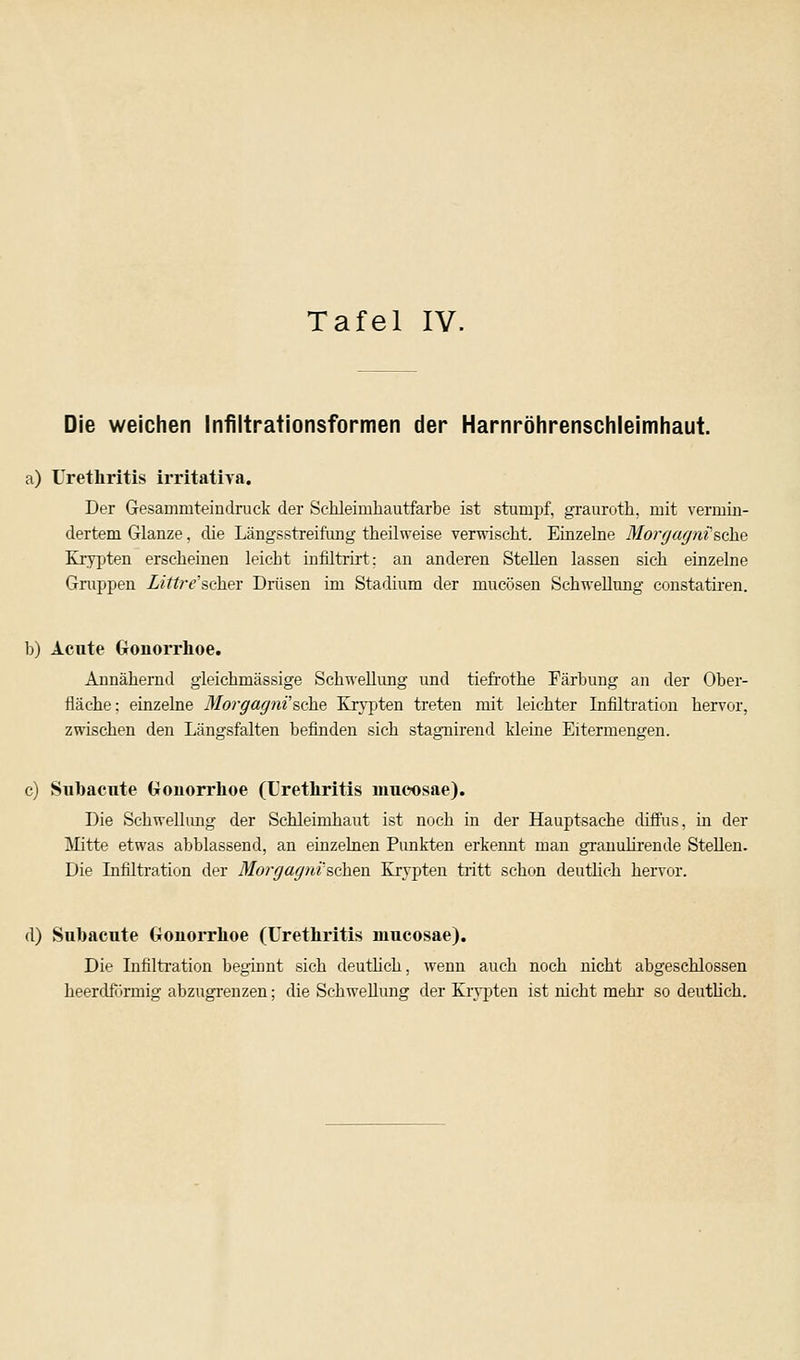 Tafel IV. Die weichen Infiltrationsformen der Harnröhrenschleimhaut. a) Urethritis irritativa. Der Gesamrateindruck der Sehleimhautfarbe ist stumpf, grauroth, mit vermin- dertem Glänze, die Längsstreifung theilweise verwischt. Einzelne Morgagni'sehe Krypten erscheinen leicht infiltrirt: an anderen Stellen lassen sich einzelne Gruppen Littre'Bcber Drüsen im Stadium der mucösen Schwellung constatiren. b) Acute Gonorrhoe. Annähernd gleichmässige Schwellung und tiefrothe Färbung an der Ober- fläche; einzelne Morgagni'sehe Krypten treten mit leichter Infiltration hervor, zwischen den Längsfalten befinden sich stagnirend kleine Eitermengen. c) Subaeute Gonorrhoe (Urethritis mucosae). Die Schwelhing der Schleimhaut ist noch in der Hauptsache diffus, in der Mitte etwas abblassend, an einzelnen Punkten erkennt man granulirende Stellen. Die Infiltration der Morgagni'sehen Krypten tritt schon deutlich hervor. d) Subaeute Gonorrhoe (Urethritis mucosae). Die Infiltration beginnt sich deutlich, wenn auch noch nicht abgeschlossen heerdformig abzugrenzen; die Schwellung der Krypten ist nicht mehr so deutlich.