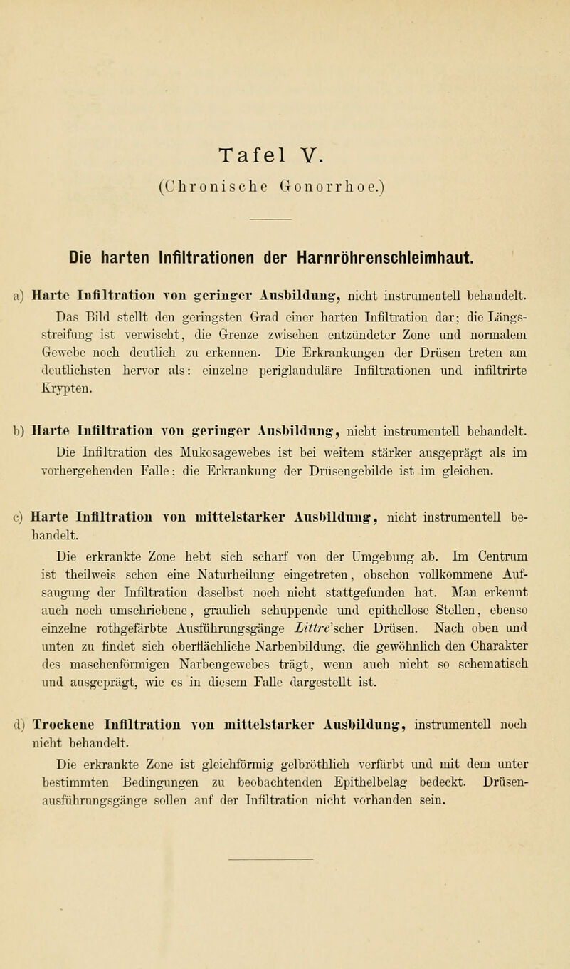 Tafel V. (Chronische Gonorrhoe.) Die harten Infiltrationen der Harnröhrenschleimhaut. a) Harte Infiltration von geringer Ausbildung, nicht instrumentell behandelt. Das Bild steht den geringsten Grad einer harten Infiltration dar; die Längs- streifung ist verwischt, die Grenze zwischen entzündeter Zone und normalem Gewebe noch deutlich zu erkennen. Die Erkrankungen der Drüsen treten am deutlichsten hervor als: einzelne periglanduläre Infiltrationen und infiltrirte Krypten. b) Harte Infiltration von geringer Ausbildung, nicht instrumentell behandelt. Die Infiltration des Mukosagewebes ist bei weitem stärker ausgeprägt als im vorhergehenden Falle: die Erkrankung der Drüsengebilde ist im gleichen. c) Harte Infiltration von mittelstarker Ausbildung, nicht instrumentell be- handelt. Die erkrankte Zone hebt sich scharf von der Umgebung ab. Im Centrum ist theüweis schon eine Naturheilung eingetreten, obschon voUkommene Auf- saugung der Infiltration daselbst noch nicht stattgefimden hat. Man erkennt auch noch umschriebene, graulich schuppende und epithellose Stehen, ebenso einzelne rothgefärbte Ausführungsgänge Littre''scher Drüsen. Nach oben und unten zu findet sich oberflächliche Narbenbildung, die gewöhnlich den Charakter des maschenförrnigen Narbengewebes trägt, wenn auch nicht so schematisch und ausgeprägt, wie es in diesem Fähe dargestellt ist. d) Trockene Infiltration von mittelstarker Ausbildung, instrumentell noch nicht behandelt. Die erkrankte Zone ist gleichförmig gelbröthlich verfärbt und mit dem unter bestimmten Bedingungen zu beobachtenden Epithelbelag bedeckt. Drüsen- ausführungsgänge sollen auf der Infiltration nicht vorhanden sein.