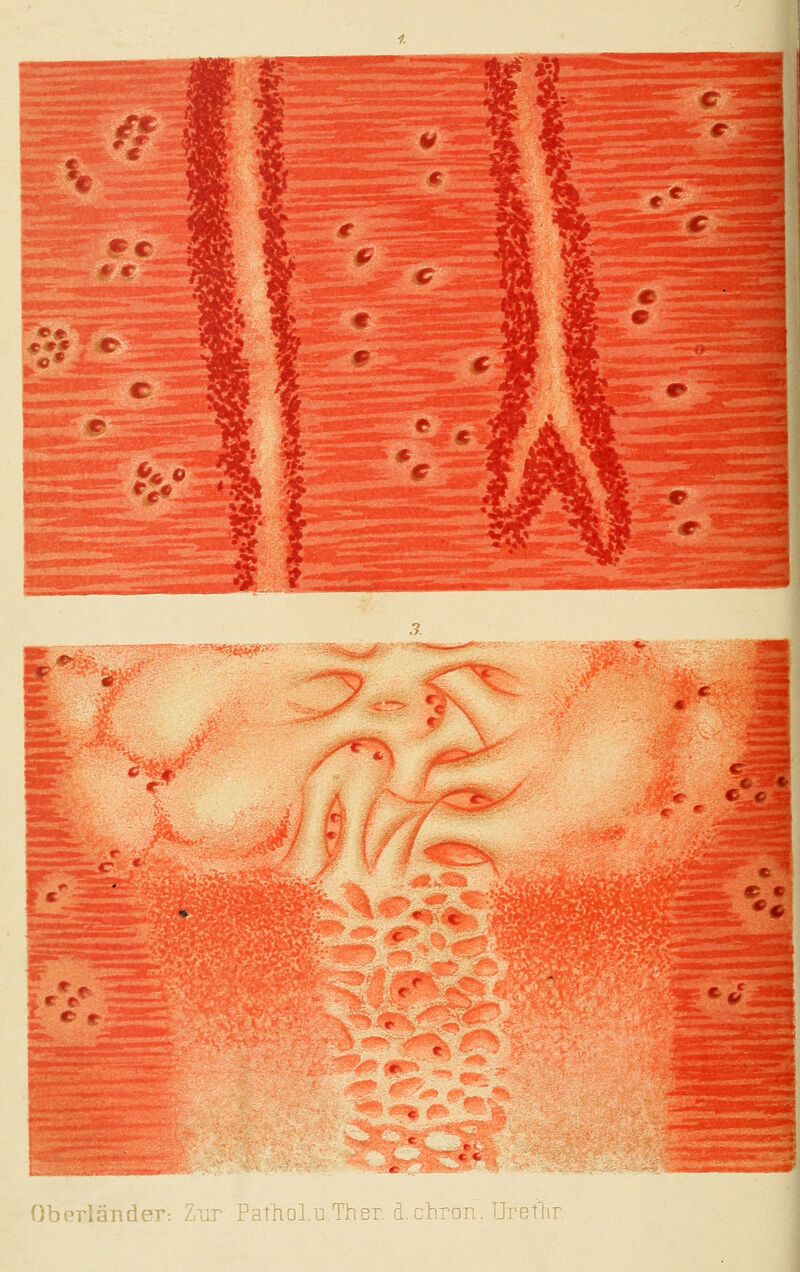 Oberländer: Zur PathoIu.Ther. d. Mretlir.