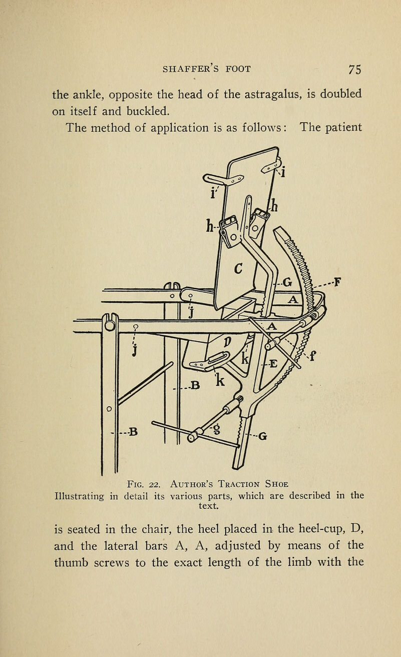 the ankle, opposite the head of the astragalus, is doubled on itself and buckled. The method of application is as follows: The patient Fig. 2'2. Author's Traction Shoe Illustrating in detail its various parts, which are described in the text. is seated in the chair, the heel placed in the heel-cup, D, and the lateral bars A, A, adjusted by means of the thumb screws to the exact length of the limb with the