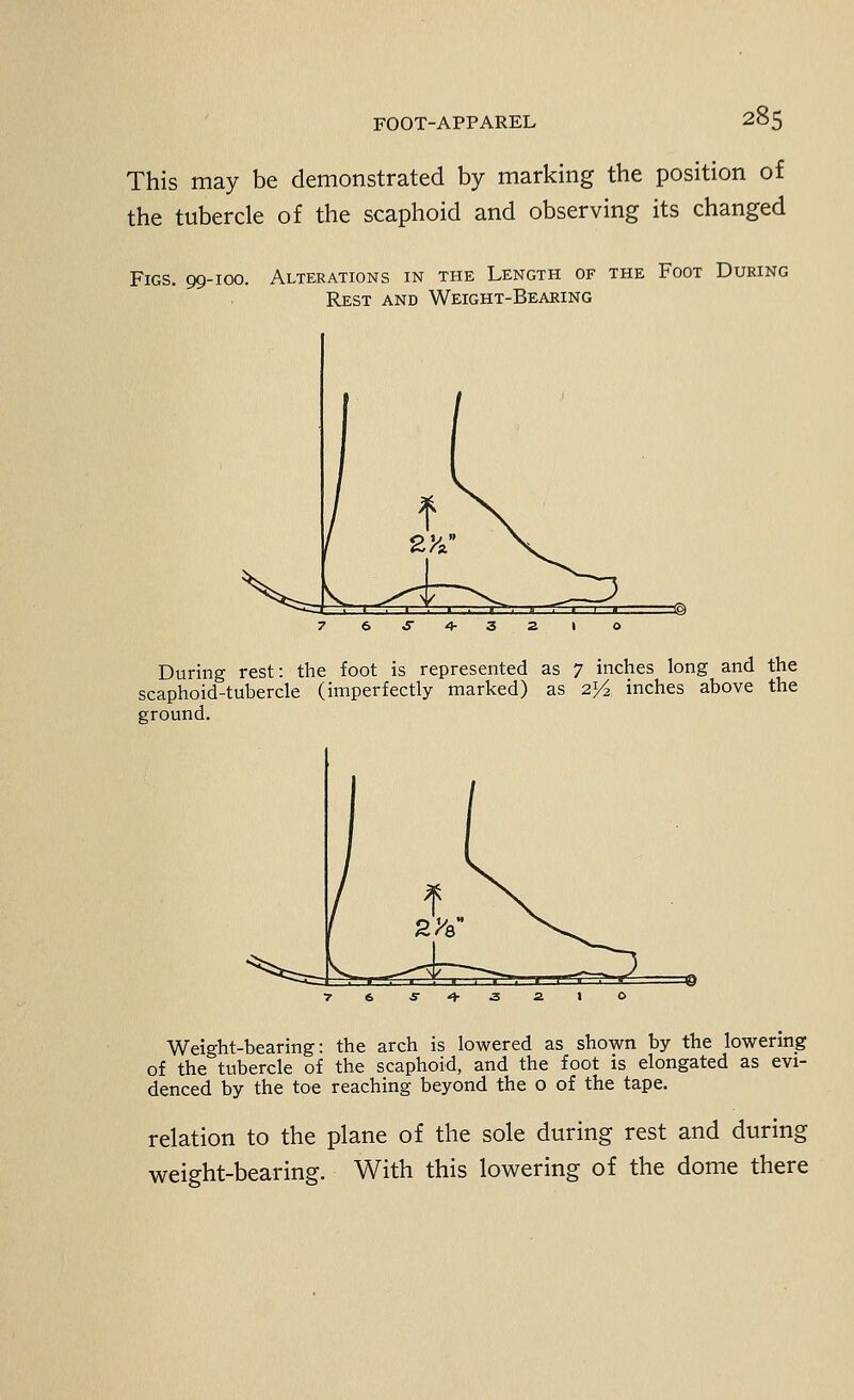 This may be demonstrated by marking the position of the tubercle o£ the scaphoid and observing its changed Figs. 99-100. Alterations in the Length of the Foot During Rest and Weight-Bearing During rest: the foot is represented as 7 inches long and the scaphoid-tubercle (imperfectly marked) as 2^ inches above the ground. Weight-bearing: the arch is lowered as shown by the lowering of the tubercle of the scaphoid, and the foot is elongated as evi- denced by the toe reaching beyond the o of the tape. relation to the plane of the sole during rest and during weight-bearing. With this lowering of the dome there