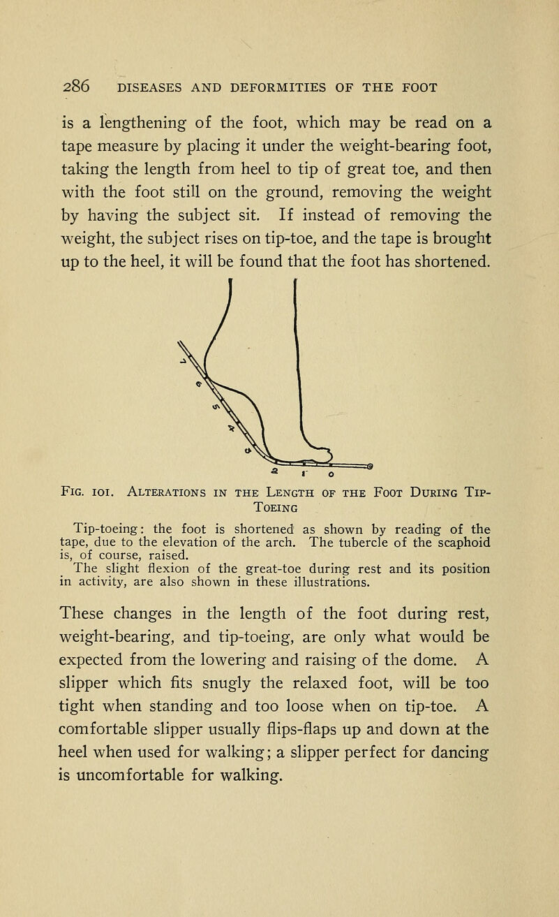 is a lengthening of the foot, which may be read on a tape measure by placing it under the weight-bearing foot, taking the length from heel to tip of great toe, and then with the foot still on the ground, removing the weight by having the subject sit. If instead of removing the weight, the subject rises on tip-toe, and the tape is brought up to the heel, it will be found that the foot has shortened. Fig. ioi. Alterations in the Length of the Foot During Tip- Toeing Tip-toeing: the foot is shortened as shown by reading of the tape, due to the elevation of the arch. The tubercle of the scaphoid is, of course, raised. The slight flexion of the great-toe during rest and its position in activity, are also shown in these illustrations. These changes in the length of the foot during rest, weight-bearing, and tip-toeing, are only what would be expected from the lowering and raising of the dome. A slipper which fits snugly the relaxed foot, will be too tight when standing and too loose when on tip-toe. A comfortable slipper usually flips-flaps up and down at the heel when used for walking; a slipper perfect for dancing is uncomfortable for walking.