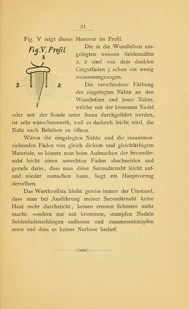 Fig. V zeigt dieses Manöver im Profil. rr. TT- n ri Die in die Wundlefzen ein- FLqY^Profd . ^ ^ ., .-^ «/ - '^ gelegten weissen beidennante V y 2, 2 sind von dem dunklen /T^ 7^ Catgutfaden 3 schon ein wenig I ' I zusammengezogen. 2, I i 2, Die verschiedene Färbung * / der eingelegten Nähte an den 1 Wundlefzen und jener Nähte, welche mit der krummen Nadel oder mit der Sonde unter ihnen durchgeführt werden, ist sehr wünschenwerth, weil es dadurch leicht wird, die Naht nach Belieben zu öffnen. Wären die eingelegten Nähte und die zusammen- ziehenden Fäden von gleich dickem und gleichfarbigem Materiale, so könnte man beim Aufmachen der Secundär- naht leicht einen unrechten Faden abschneiden und gerade darin, dass man diese Secundärnaht leicht auf- und wieder zumachen kann, liegt ein Hauptvorzug derselben. Das Werthvollste bleibt gewiss immer der Umstand, dass man bei Ausführung meiner Secundärnaht keine Haut mehr durchsticht, keinen ernsten Schmerz mehr macht, sondern nur mit krummen, stumpfen Nadeln Seidenfadenschiingen auffassen und zusammenknüpfen muss und dass es keiner Narkose bedarf.