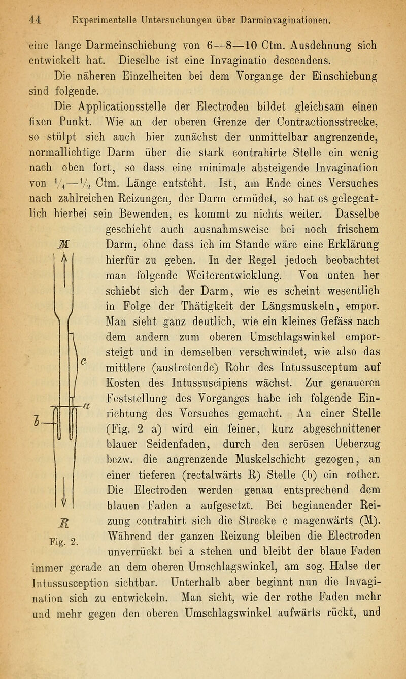 eine lange Darmeinschiebung von 6—8—10 Ctm. Ausdehnung sich entwickelt hat. Dieselbe ist eine Invaginatio descendens. Die näheren Einzelheiten bei dem Vorgange der Einschiebung sind folgende. Die Applicationsstelle der Electroden bildet gleichsam einen fixen Punkt. Wie an der oberen Grenze der Contractionsstrecke, so stülpt sich auch hier zunächst der unmittelbar angrenzende, normallichtige Darm über die stark contrahirte Stelle ein wenig nach oben fort, so dass eine minimale absteigende Invagination von \'i—Vo Ctm. Länge entsteht. Ist, am Ende eines Versuches nach zahlreichen Reizungen, der Darm ermüdet, so hat es gelegent- lich hierbei sein Bewenden, es kommt zu nichts weiter. Dasselbe geschieht auch ausnahmsweise bei noch frischem M Darm, ohne dass ich im Stande wäre eine Erklärung hierfür zu geben. In der Regel jedoch beobachtet man folgende Weiterentwicklung. Von unten her schiebt sich der Darm, wie es scheint wesentlich in Folge der Thätigkeit der Längsmuskeln, empor. Man sieht ganz deutlich, wie ein kleines Gefäss nach dem andern zum oberen Umschlagswinkel empor- steigt und in demselben verschwindet, wie also das mittlere (austretende) Rohr des Intussusceptum auf Kosten des Intussuscipiens wächst. Zur genaueren Feststellung des Vorganges habe ich folgende Ein- richtung des Versuches gemacht. An einer Stelle (Fig. 2 a) wird ein feiner, kurz abgeschnittener blauer Seidenfaden, durch den serösen üeberzug bezw. die angrenzende Muskelschicht gezogen, an einer tieferen (rectalwärts R) Stelle (b) ein rother. Die Electroden werden genau entsprechend dem blauen Faden a aufgesetzt. Bei beginnender Rei- zung contrahirt sich die Strecke c magenwärts (M). Während der ganzen Reizung bleiben die Electroden unverrückt bei a stehen und bleibt der blaue Faden immer gerade an dem oberen Umschlagswinkel, am sog. Halse der lutussusception sichtbar. Unterhalb aber beginnt nun die Invagi- nation sich zu entwickeln. Man sieht, wie der rothe Faden mehr und mehr gegen den oberen Umschlagswinkel aufwärts rückt, und Fig. 2.