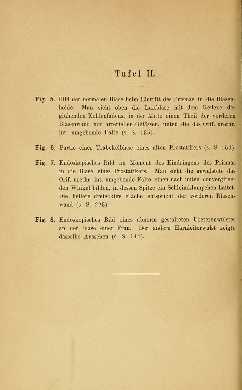 Fig. 5. Bild der normalen Blase beim Eintritt des Prismas in die Blasen- höhle. Man sieht oben die Luftblase mit dem Reflexe des glühenden Kohlenfadens, in der Mitte einen Theil der vorderen Blasenwand mit arteriellen Gefässen, unten die das Orif. urethr. int. umgebende Falte (s. S. 135). Fig. 6. Partie einer Trabekelblase eines alten Prostatikers (s. S. 154). Fig. 7. Endoskopisches Bild im Moment des Eindringens des Prismas in die Blase eines Prostatikers. Man sieht die gewulstete das Orif. urethr. int. umgebende Falte einen nach unten convergiren- den Winkel bilden, in dessen Spitze ein Schleimklümpchen haftet. Die hellere dreieckige Fläche entspricht der vorderen Blasen- wand (s. S. 223). Fig. 8. Endoskopisches Bild eines abnorm gestalteten Ureterenwulstes an der Blase einer Frau. Der andere Harnleiterwulst zeigte dasselbe Aussehen (s. S. 144).