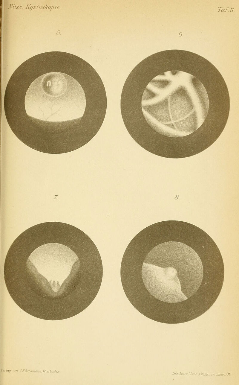 XUze. Kystoskopic. 8. '^irgm/mn, Wiesba<Hen. Uth.Anst v.Werncrl^h'uiif: