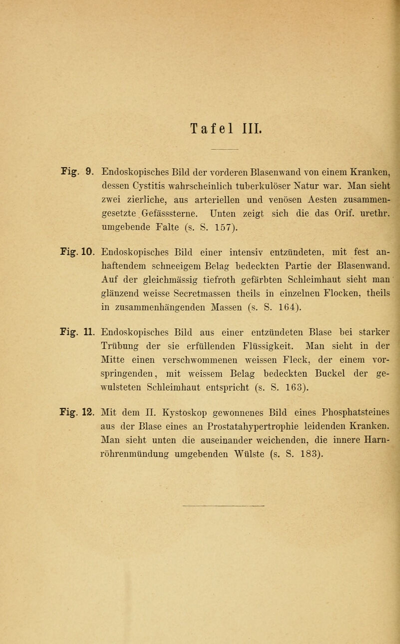 Fig. 9. Endoskopisches Bild der vorderen Blaseuwand von einem Kranken, dessen Cystitis wahrscheinlich tuberkulöser Natur war. Man sieht zwei zierliche, aus arteriellen und venösen Aesten zusammen- gesetzte Gefässsterne. Unten zeigt sich die das Orif. urethr. umgebende Falte (s. S. 157). Fig. 10. Endoskopisches Bild einer intensiv entzündeten, mit fest an- haftendem schneeigem Belag bedeckten Partie der Blasenwand. Auf der gleichmässig tiefroth gefärbten Schleimhaut sieht man glänzend weisse Secretmassen theils in einzelnen Flocken, theils in zusammenhängenden Massen (s. S. 164). Fig. 11. Endoskopisches Bild aus einer entzündeten Blase bei starker Trübung der sie erfüllenden Flüssigkeit. Man sieht in der Mitte einen verschwommenen weissen Fleck, der einem vor- springenden, mit weissem Belag bedeckten Buckel der ge- wulsteten Schleimhaut entspricht (s. S. 163). Fig. 12. Mit dem II. Kystoskop gewonnenes Bild eines Phosphatsteines aus der Blase eines an Prostatahypertrophie leidenden Kranken. Man sieht unten die auseinander weichenden, die innere Harn- röhrenmündung umgebenden Wülste (s. S. 183).