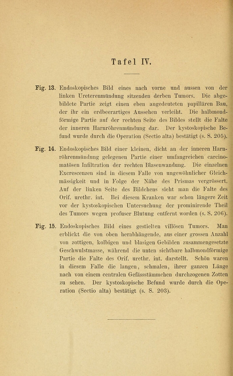 Fig. 13. Endoskopisches Bild eines nach vorne und aussen von der linken Ureterenmündung sitzenden derben Tumors. Die abge- bildete Partie zeigt einen eben angedeuteten papillären Bau, der ihr ein erdbeerartiges Aussehen verleiht. Die halbmond- förmige Partie auf der rechten Seite des Bildes stellt die Falte der inneren Harnröhrenmündung dar. Der kystoskopische Be- fund wurde durch die Operation (Sectio alta) bestätigt (s. S. 205). Fig. 14. Endoskopisches Bild einer kleinen, dicht an der inneren Harn- röhrenmündung gelegenen Partie einer umfangreichen carciuo- matösen Infiltration der rechten Blasenwandung. Die einzelnen Excrescenzen sind in diesem Falle von ungewöhnlicher Gleich- mässigkeit und in Folge der Nähe des Prismas vergrössert. Auf der linken Seite des Bildchens sieht man die Falte des Orif. urethr. int. Bei diesem Kranken war schon längere Zeit vor der kystoskopischen Untersuchung der prominirende Theil des Tumors wegen profuser Blutung entfernt worden (s. S. 206). Fig. 15. Endoskopisches Bild eines gestielten villösen Tumors. Man erblickt die von oben herabhängende, aus einer grossen Anzahl von zottigen, kolbigen und blasigen Gebilden zusammengesetzte Greschwulstmasse, während die unten sichtbare halbmondförmige Partie die Falte des Orif. urethr. int. darstellt. Schön waren in diesem Falle die langen, schmalen, ihrer ganzen Länge nach von einem centralen Grefässstämmchen durchzogenen Zotten zu sehen. Der kystoskopische Befund wurde durch die Ope- ration (Sectio alta) bestätigt (s. S. 203),
