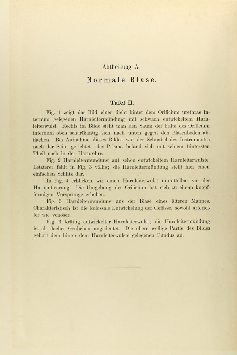 Normale Blase. Tafel II. Fig. 1 zeigt das Bild einer dicht hinter dem Orificium urethrae in- ternum gelegenen Harnleitermünduug mit schwach entwickeltem Harn- leiterwulst. Rechts im Bilde sieht man den Saum der Falte des Orificium internum oben scharfkantig sich nach unten gegen den Blasenboden ab- flachen. Bei Aufnahme dieses Bildes war der Schnabel des Instrumentes nach der Seite gerichtet; das Prisma befand sich mit seinem hintersten Theil noch in der Harnröhre. Fig. 2 Harnleitermündung auf schon entwickeltem Harnleiterwulste. Letzterer fehlt in Fig. 3 völlig; die Harnleitermündung stellt hier einen einfachen Schlitz dar. In Fig. 4 erblicken wir einen Harnleiterwulst unmittelbar vor der Harnentleerung. Die Umgebung des Orificium hat sich zu einem knopf- förmigen Vorsprunge erhoben. Fig. 5 Ilarnleitermündung aus der Blase eines älteren Mannes. Charakteristisch ist die kolossale Entwickelung der Gefässe, sowohl arteriel- ler wie venöser. Fig. (j kräftig entwickelter Harnleiterwulst; die Harnleitermünduug ist als flaclies Grübchen angedeutet. Die obere wellige Partie des Bildes gehört dem hinter dem Harnleiterwulste gelegenen Fundus an.