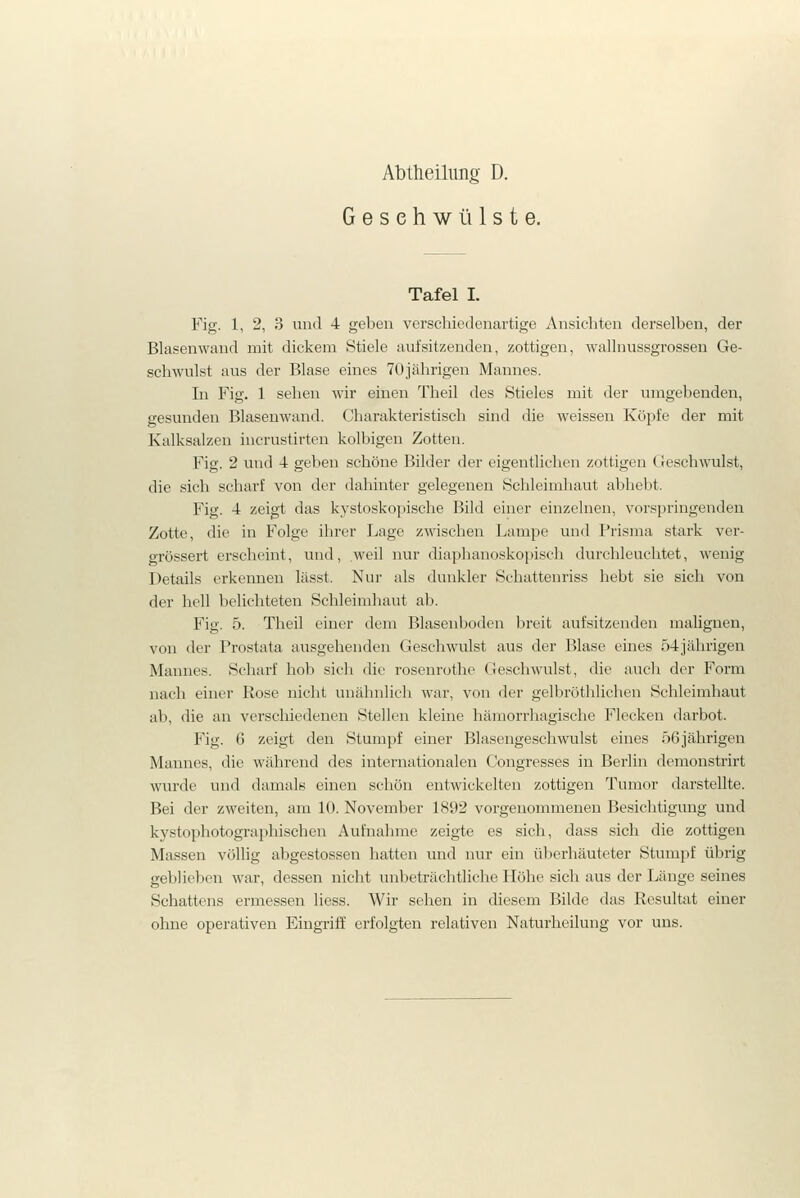 Gesehwülste. Tafel I. Fig. 1, 2, 3 und 4 geben verschiedenartige Ansichten derselben, der Blasenwand mit dickem Stiele aufsitzenden, zottigen, wallnussgrossen Ge- schwulst aus der Blase eines TOjährigen Mannes. In Fig. 1 sehen wir einen Theil des Stieles mit der umgebenden, gesunden Blaseuwand. Charakteristisch sind die weissen Köpfe der mit Kalksalzen incrustirten kolbigen Zotten. Fig. 2 und 4 geben schöne Bilder der eigentlichen zottigen (reschwulst, die sich scharf von der dahinter gelegenen Schleimhaut abhebt. Fig. 4 zeigt das kystoskopische Bild einer einzelnen, vorspringenden Zotte, die in Folge ihrer Lage zwischen Lampe und Prisina stark ver- grössert erscheint, und, weil nur diaphanoskopisch durchleuchtet, wenig Details erkennen lässt. Nur als dunkler Schattenriss hebt sie sich von der hell belichteten Schleimhaut ab. Fig. 5. Theil einer dem Blasenboden breit aufsitzenden malignen, von der Prostata ausgehenden Geschwulst aus der Blase eines 54jährigen Mannes. Scharf hob sich die rosenrothe Geschwulst, die auch der Form nach einer Rose nicht unähnlich war, von der gelbröthlichen Schleimhaut ab, die an verschiedenen Stellen kleine hämorrhagische Flecken darbot. Fig. 6 zeigt den Stumpf einer Blasengeschwulst eines 56jährigen Mannes, die während des internationalen Congresses in Berlin demonstrirt wurde und damals einen schön entwickelten zottigen Tumor darstellte. Bei der zweiten, am 10. November 1892 vorgenommenen Besichtigung und kystophotographischen Aufnahme zeigte es sich, dass sich die zottigen Massen völlig abgestossen hatten und nur ein überhäuteter Stumpf übrig geblieben war, dessen nicht unbeträchtliche Höhe sich aus der Länge seines Schattens ermessen Hess. Wir sehen in diesem Bilde das Resultat einer ohne operativen Eingriff erfolgten relativen Naturheilung vor uns.