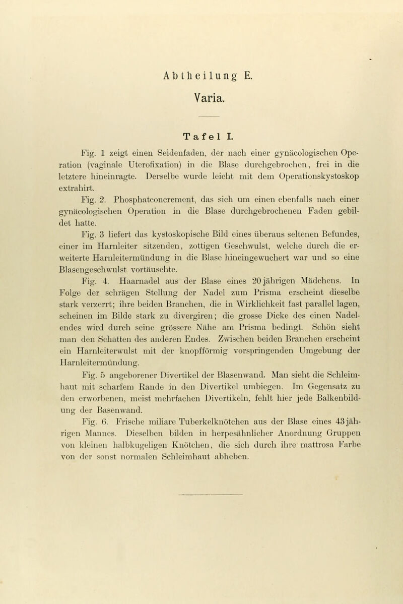 Varia. Tafel I. Fig. 1 zeigt einen Seideufaden, der nach einer gynäcologischen Ope- ration (vaginale Uterofixation) in die Blase durchgebrochen, frei in die letztere hineinragte. Derselbe wurde leicht mit dem Operationskystoskop extrahirt. Fig. 2. Phosphatconcrement, das sich um einen ebenfalls nach einer gynäcologischen Operation in die Blase durchgebrochenen Faden gebil- det hatte. Fig. 3 liefert das kystoskopische Bild eines überaus seltenen Befundes, einer im Harnleiter sitzenden, zottigen Geschwulst, welche durch die er- weiterte Harnleitermündung in die Blase hineingewuchert war und so eine Blasengeschwulst vortäuschte. Fig. 4. Haarnadel aus der Blase eines 20 jährigen Mädchens. In Folge der schrägen Stellung der Nadel zum Prisma erscheint dieselbe stark verzerrt; ihre beiden Branchen, die in Wirklichkeit fast parallel lagen, scheinen im Bilde stark zu divergiren; die grosse Dicke des einen Nadel- endes wird durch seine grössere Nähe am Prisma bedingt. Schön sieht man den Schatten des anderen Endes. Zwischen beiden Branchen erscheint ein Harnleiterwulst mit der knopfförmig vorspringenden Umgebung der Harnleitermündung. Fig. 5 angeborener Divertikel der Blasenwand. Man sieht die Schleim- haut mit scharfem Rande in den Divertikel umbiegen. Im Gegensatz zu den erworbenen, meist mehrfachen Divertikeln, fehlt hier jede Balkenbild- ung der Basenwand. Fig. 6. Frische miliare Tuberkelknötchen aus der Blase eines 43 jäh- rigen Mannes. Dieselben bilden in herpesähnlicher Anordnung Gruppen von kleinen halbkugeligen Knötchen, die sich durch ihre mattrosa Farbe von der sonst normalen Schleimhaut abheben.