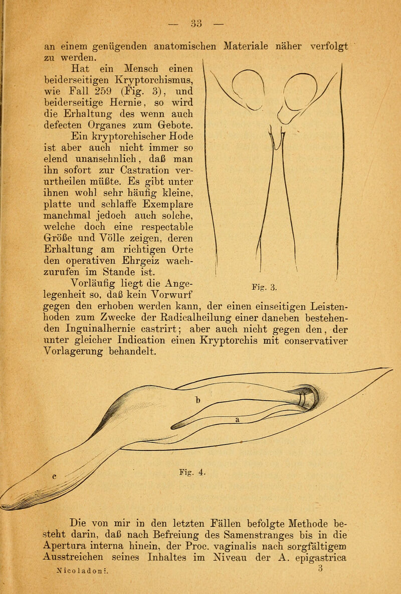 an einem genügenden anatomischen Materiale näher verfolgt zu werden. einen Hat ein Mensch beiderseitigen Kryptorchismus, wie Fall 259 (Fig. 3), und beiderseitige Hernie, so wird die Erhaltung des wenn auch defecten Organes zum Gebote. Ein kryptorchischer Hode ist aber auch nicht immer so elend unansehnlich, daß man ihn sofort zur Castration ver- urtheilen müßte. Es gibt unter ihnen wohl sehr häufig kleine, platte und schlaflPe Exemplare manchmal jedoch auch solche, welche doch eine respectable Größe und Völle zeigen, deren Erhaltung am richtigen Orte den operativen Ehrgeiz wach- zurufen im Stande ist. Vorläufig liegt die Ange- legenheit so, daß kein Vorwurf gegen den erhoben werden kann, der einen einseitigen Leisten- hoden zum Zwecke der Radicalheilung einer daneben bestehen- den Inguinalhernie castrirt; aber auch nicht gegen den, der unter gleicher Indication einen Kryptorchis mit conservativer Vorlagerung behandelt. Fig. 3. Die von mir in den letzten Fällen befolgte Methode be- steht darin, daß nach Befreiung des Samenstranges bis in die Apertura interna hinein, der Proc. vaginalis nach sorgfältigem Ausstreichen seines Inhaltes im Niveau der A. epigastrica Xicoladoni.