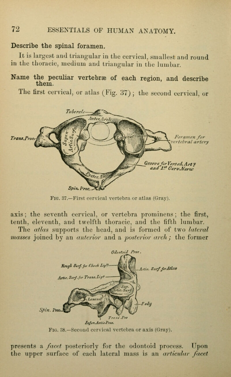 Describe the spinal foramen. It is largest and triangular in tlie cervical, smallest and round in the thoracic, medium and triangular in the lumbar. Name the peculiar vertebrse of each region, and describe them. The first cervical, or atlas (Fig. 37) ; the second cervical, or Traiu.Proct Forai7ten /or 'ertebral artery GTOoi/efcr YerceS, Arty ajid If. Cerv.N£rii£ Spin, pToc. Fig. 37.—First cervical vertebra or atlas (Gray). axis; the seventh cervical, or vertebra prominens; the first, tenth, eleventh, and twelfth thoracic, and the fifth lumbar. The aflaa supports the head, and is formed of two lateral masses joined by an anterior and a jjosterior arch; the former OionUil Pros, Ajrti> j^-ArUe. SurffoiAtlas -i\-Pody spin. I'Toe.. 1^ T rant. Pro ZnffT^Tlie.t'roe. Fig. 38.—Second cervical vertebra or axis (Gray). presents a facet posteriorly for the odontoid process. Upon the upper surface of each lateral mass is an articular facet