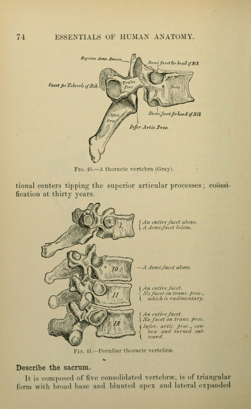 Dtn'i facet for/iraiof Sii Sa^rricT Artie, troceii /,' \ DemiJacetforluaA Cfjiii Infer. Artie .Proc. Fig. 40.—A thoracic vertebra (Gray). tional centers tipping the superior articular processes; cobssi- fication at thirty years. {An entire facet above. A demi-facet below. —A detni-facet above. (An entire facet. X No facet on trans, proc, ( ivhich is rudimentary. (An entire facet. \ No facet on trans, proc. (Infer, artic. proc, con- < ziex and turned out- (^ 7vard. Fio. 41.—Peculiar thoracic vertebrae. Describe the sacrum. It is composed of five consolidated vertebrae, is of triangular form with broad base and blunted apex and lateral expanded