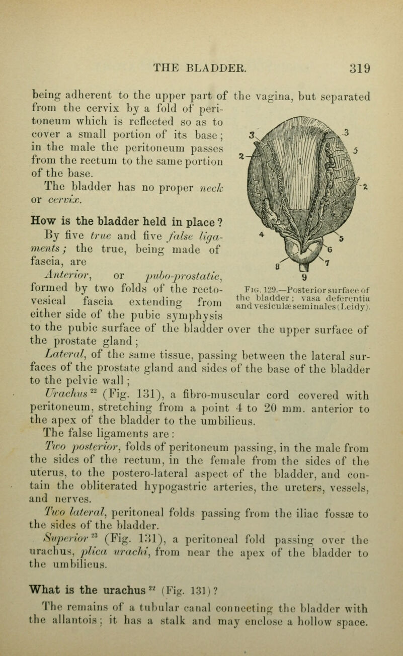 being adherent to the upper part of the vagina, but separated from the cervix by a fold of peri- toneum which is reflected so as to cover a small portion of its base ; in the male the peritoneum passes from the rectum to the same portion of the base. The bladder has no proper neck or cervix. Fig. 129.—Posterior surface of the bladder; vasa deferentia and vesiculse seminales (Leidyj. How is the bladder held in place ? By five true and five false liga- ments; the true, being made of fascia, are Anterior.^ or puho-prostatic, formed by two folds of the recto- vesical fascia extending from either side of the pubic symphysis to the pubic surface of the bladder over the upper surface of the prostate gland ; Lateral, of the same tissue, passing between the lateral sur- faces of the prostate gland and sides of the base of the bladder to the pelvic wall; Urachiis'^'^ (Fig. 131), a fibro-muscular cord covered with peritoneum, stretching from a point 4 to 20 mm. anterior to the apex of the bladder to the umbilicus. The false ligaments are : Ty:o posterior, folds of peritoneum passing, in the male from the sides of the rectum, in the female from the sides of the uterus, to the postero-lateral aspect of the bladder, and con- tain the obliterated hypogastric arteries, the ureters, vessels, and nerves. Two lateral, peritoneal folds passing from the iliac fossa) to the sides of the bladder. Superior'^^ (Fig. IIU), a peritoneal fold passing over the uracil us, plica nrachi, from near the apex of the bladder to the umbilicus. What is the urachus (Fi<?. 131)? The remains of a tubular canal connecting the bladder with the allantois : it has a stalk and may enclose a hollow space.