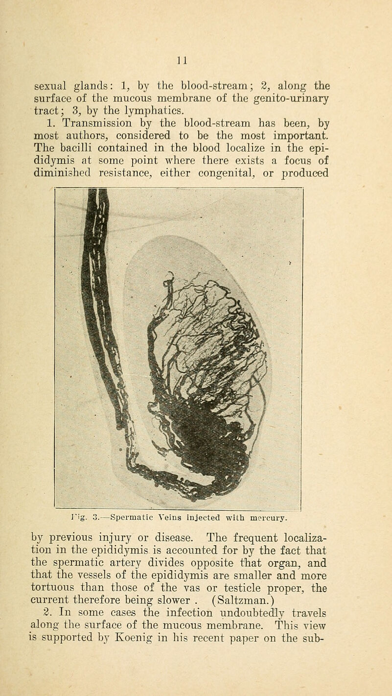 u sexual glands: 1, by the blood-stream; 2, along the surface of the mucous membrane of the genito-urinary tract; 3, by the lymphatics. 1. Transmission by the blood-stream has been, by most authors, considered to be the most important. The bacilli contained in the blood localize in the epi- didymis at some point M'here there exists a focus of diminished resistance, either congenital, or produced 3.—Spermatic Veins injected with mercury. by previous injury or disease. The frequent localiza- tion in the epididymis is accounted for by the fact that the spermatic artery divides opposite that organ, and that the vessels of the epididymis are smaller and more tortuous than those of the vas or testicle proper, the current therefore being slower . (Saltzman.) 2. In some cases the infection undoubtedly travels along the surface of the mucous membrane. This view is supported by Koenig in his recent paper on the sub-