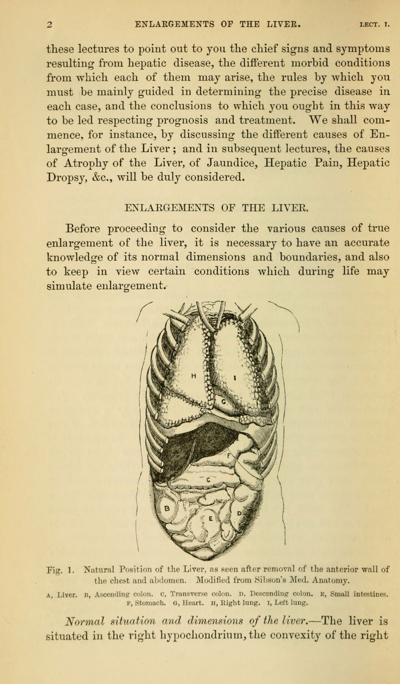 these lectures to point out to you the chief signs and symptoms resulting from hepatic disease, the different morbid conditions from which each of them may arise, the rules by which you must be mainly guided in determining the precise disease in each case, and the conclusions to which you ought in this way to be led respecting prognosis and treatment. We shall com- mence, for instance, by discussing the different causes of En- largement of the Liver ; and in subsequent lectures, the causes of Atrophy of the Liver, of Jaundice, Hepatic Pain, Hepatic Dropsy, &c., will be duly considered. ENLAKGEMENTS OF THE LIVER. Before proceeding to consider the various causes of true enlargement of the liver, it is necessary to have an accurate knowledge of its normal dimensions and boundaries, and also to keep in view certain conditions which during life may simulate enlargement. Fig. 1. Natural Position of the Liver, as seen after removal of the anterior wall of the chest and abdomen. Modified from JSibson's Med. Anatomy. A, Liver, b, Ascending colon, c, Transverse colon. D, Descandinp colon, e, Small intestines. F, Stomach, o, Heart, ii, Right lung. I, Left lung. Normal situation and dimensions of the liver.—The liver is situated in the right hypochondrium,the convexity of the right