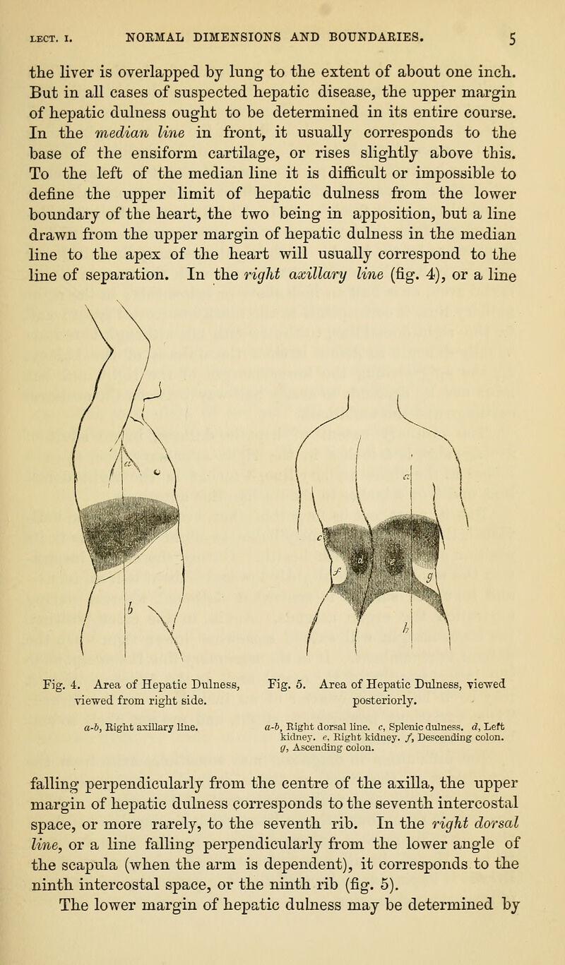 the liver is overlapped by lung to tlie extent of about one incb. But in all cases of suspected hepatic disease, the upper margin of hepatic dulness ought to be determined in its entire course. In the median line in front, it usually corresponds to the base of the ensiform cartilage, or rises slightly above this. To the left of the median line it is difficult or impossible to define the upper limit of hepatic dulness from the lower boundary of the heart, the two being in apposition, but a line drawn from the upper margin of hepatic dalness in the median line to the apex of the heart will usually correspond to the line of separation. In the ricjht axillary line (fig. 4), or a line Fig. 4. Area of Hepatic Dulness, Fig. 5. Area of Hepatic Dulness, Tie^wed viewed from right side. posteriorly. a-h, Eight axillary line. a-l. Right dorsal line, c, Splenic dulness. d, Left kidney, e. Right kidney. /, Descending colon. g. Ascending colou. falling perpendicularly from the centre of the axilla, the upper margin of hepatic dulness corresponds to the seventh intercostal space, or more rarely, to the seventh rib. In the right dorsal line, or a line falling perpendicularly from the lower angle of the scapula (when the arm is dependent), it corresponds to the ninth intercostal space, or the ninth rib (fig. 5). The lower margin of hepatic dulness may be determined by