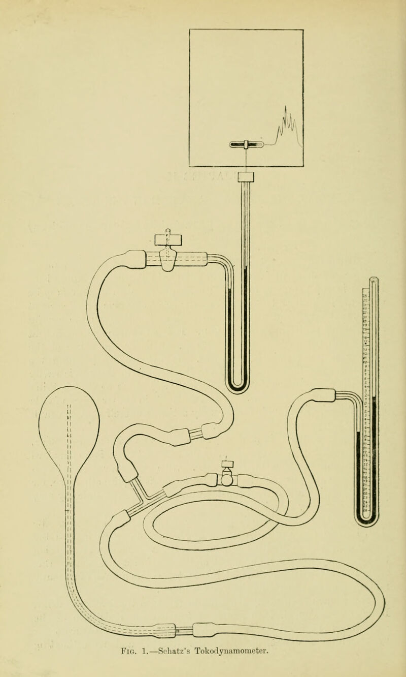 Fig. L—Schatz's Tokodynamomete