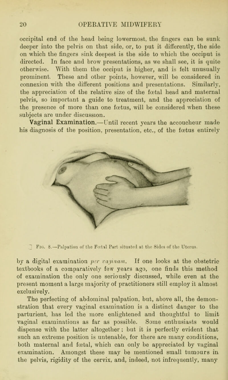 occipital end of the head being lowermost, the fingers can be sunk deeper into the pelvis on that side, or, to put it differently, the Bide on which the fingers sink deepest is the side to which the occiput is directed. In face and brow presentations, as we shall see, it is quite otherwise. With them the occiput is higher, and is felt unusually prominent. These and other points, however, will be considered in connexion with the different positions and presentations. Similarly, the appreciation of the relative size of the foetal head and maternal pelvis, so important a guide to treatment, and the appreciation of the presence of more than one fcetus, will be considered when these subjects are under discussion. Vaginal Examination.—Cntil recent years the accoucheur made his diagnosis of the position, presentation, etc., of the fcetus entirely ] Fig. 8.—Palpation of the Fcetal Part situated at the Sides of the Uterus. by a digital examination per vaginam. If one looks at the obstetric textbooks of a comparatively few years ago, one finds this method of examination the only one seriously discussed, while even at the present moment a large majority of practitioners still employ it almost exclusively. The perfecting of abdominal palpation, but, above all, the demon- stration that every vaginal examination is a distinct danger to the parturient, has led the more enlightened and thoughtful to limit vaginal examinations as far as possible. Some enthusiasts would dispense with the latter altogether ; but it is perfectly evident that such an extreme position is untenable, for there are many conditions, both maternal and foetal, which can only be appreciated by vaginal examination. Amongst these may be mentioned small tumours in the pelvis, rigidity of the cervix, and, indeed, not infrequently, many