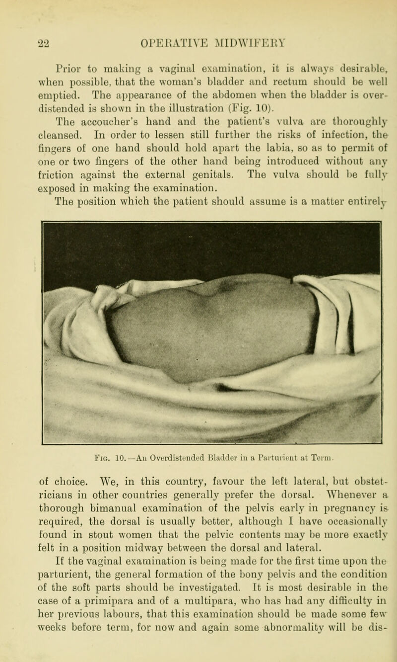 Prior to making a vaginal examination, it is always desirable, when possible, that the woman's bladder and rectum should be well emptied. The appearance of the abdomen when the bladder is over- distended is shown in the illustration (Fig. 10). The accoucher's band and the patient's vulva are thoroughly cleansed. In order to lessen still further the risks of infection, the fingers of one hand should hold apart the labia, so as to permit of one or two fingers of the other hand being introduced without any friction against the external genitals. The vulva should be fully exposed in making the examination. The position which the patient should assume is a matter entirely Fio. 10.—An Overdistended Bladder in a Parturient at Term of choice. We, in this country, favour the left lateral, but obstet- ricians in other countries generally prefer the dorsal. Whenever a thorough bimanual examination of the pelvis early in pregnancy is required, the dorsal is usually better, although I have occasionally found in stout women that the pelvic contents may he more exactly felt in a position midway between the dorsal and lateral. If the vaginal examination is being made for the first time upon th< parturient, the general formation of the bony pelvis and the condition of the soft parts should be investigated. It is most desirable in the case of a primipara and of a multipara, who has had any difficulty in her previous labours, that this examination should be made some few weeks before term, for now and again some abnormality will be dis-