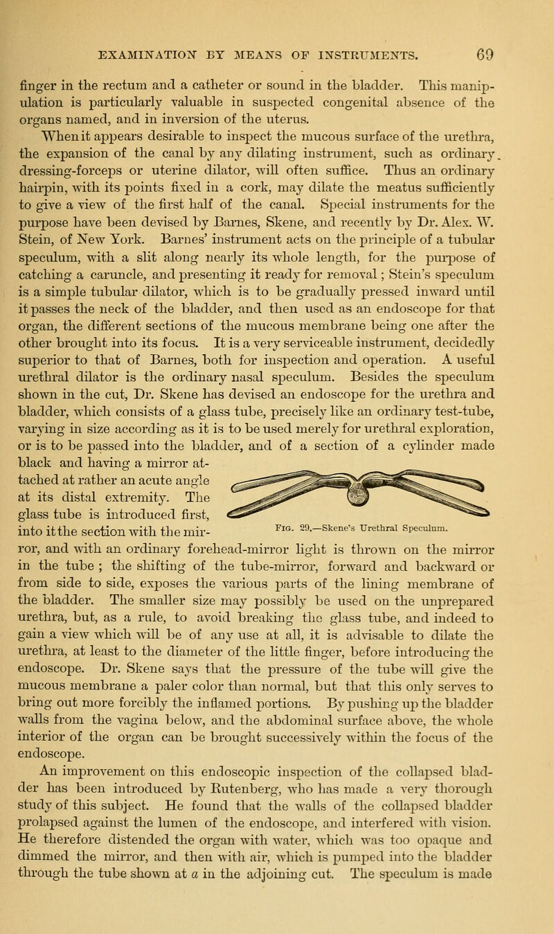jBnger in the rectum and a catheter or sound in the bladder. This manip- ulation is particularly valuable in susjDected congenital absence of the organs named, and in inversion of the uterus. When it ajDpears desirable to insjDect the mucous surface of the urethra, the expansion of the canal by any dilating instrument, such as ordinary, dressing-forceps or uterine dilator, will often suffice. Thus an ordinary hairpin, with its points fixed in a cork, may dilate the meatus sufficiently to give a view of the first half of the canal. Special instruments for the purpose have been devised by Barnes, Skene, and recently by Di-. Alex. W. Stein, of New York. Barnes' instrument acts on the principle of a tubular speculum, with a slit along nearly its whole length, for the purpose of catching a caruncle, and presenting it ready for removal; Stein's specidum is a simple tubular dilator, which is to be gradually pressed inward until it passes the neck of the bladder, and then used as an endoscope for that organ, the different sections of the mucous membi'ane being one after the other brought into its focus. It is a very serviceable instrument, decidedly superior to that of Barnes, both for inspection and operation. A useful ui'ethral dilator is the ordinary nasal speculum. Besides the speculum shown in the cut. Dr. Skene has devised an endoscope for the urethra and bladder, which consists of a glass tube, precisely like an ordinary test-tube, varying in size according as it is to be used merely for urethral exploration, or is to be passed into the bladder, and of a section of a cylinder made black and having a mirror at- tached at rather an acute angle at its distal extremity. The glass tube is introduced first, into it the section with the mir- ^'^- 29.-Skene's urethral Speculnm. ror, and with an ordinary forehead-mirror light is thrown on the mirror in the tube ; the shifting of the tube-mirror, forward and backward or from side to side, exposes the various parts of the lining membrane of the bladder. The smaller size may possibly be used on the unprepared urethra, but, as a rule, to avoid breaking the glass tube, and indeed to gain a view which will be of any use at all, it is advisable to dilate the urethra, at least to the diameter of the little finger, before introducing the endoscope. Dr. Skene says that the pressure of the tube will give the mucous membrane a paler color than normal, but that this only serves to bring out more forcibly the inflamed portions. By pushing up the bladder walls from the vagina below, and the abdominal surface above, the whole interior of the organ can be brought successively within the focus of the endoscope. An improvement on this endoscopic insj)ection of the collapsed blad- der has been introduced by Rutenberg, who has made a very thorough study of this subject. He found that the walls of the coUapsed bladder prolapsed against the lumen of the endoscope, and interfered with vision. He therefore distended the organ with water, which was too opaque and dimmed the mirror, and then with air, which is pumped into the bladder through the tube shown at a in the adjoining cut. The speculum is made
