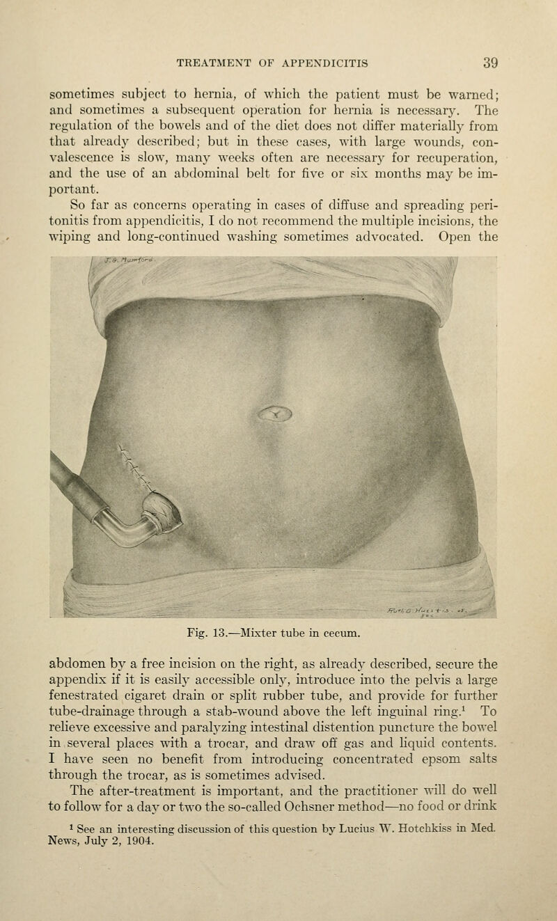 sometimes subject to hernia, of which the patient must be warned; and sometimes a subsequent operation for hernia is necessary. The reg'uUition of the bowels and of the diet does not differ materially from that already described; but in these cases, with large wounds, con- valescence is slow, many weeks often are necessary for recuperation, and the use of an abdominal belt for five or six months may be im- portant. So far as concerns operating in cases of diffuse and spreading peri- tonitis from appendicitis, I do not recommend the multiple incisions, the wijDing and long-continued washing sometimes advocated. Open the Fie;. 13.—Mixter tube in cecum. abdomen by a free incision on the right, as already described, secure the appendix if it is easily accessible only, introduce into the pelvis a large fenestrated cigaret drain or split rubber tube, and provide for further tube-drainage through a stab-wound above the left inguinal ring.^ To relieve excessive and paralyzing intestinal distention puncture the bowel in several places with a trocar, and draw off gas and Hquid contents. I have seen no benefit from introducing concentrated epsom salts through the trocar, as is sometimes advised. The after-treatment is important, and the practitioner will do well to follow for a day or two the so-called Ochsner method—no food or drink 1 See an interesting discussion of this question by Lucius W. Hotchkiss in Med. News, July 2, 1904.