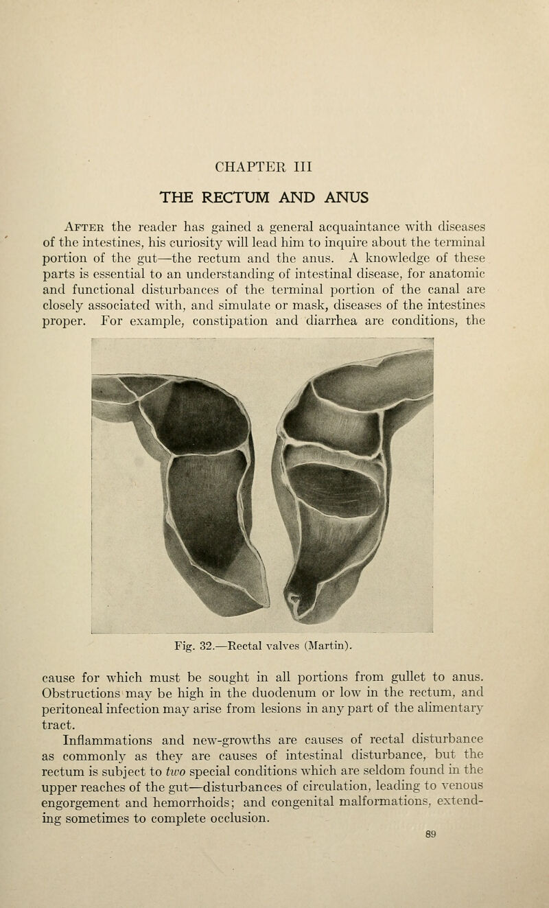 CHAPTER III THE RECTUM AND ANUS After the reader has gained a general acquaintance with diseases of the intestines, his curiosity will lead him to inquire about the terminal portion of the gut—the rectum and the anus. A knowledge of these parts is essential to an understanding of intestinal disease, for anatomic and functional disturbances of the terminal portion of the canal are closely associated with, and simulate or mask, diseases of the intestines proper. For example, constipation and diarrhea are conditions, the Rectal valves (Martin). cause for which must be sought in all portions from gullet to anus. Obstructions may be high in the duodenum or low in the rectum, and peritoneal infection may arise from lesions in any part of the alimentary tract. Inflammations and new-growths are causes of rectal disturbance as commonly as they are causes of intestinal disturbance,^ but the rectum is subject to tico special conditions which are seldom found in the upper reaches of the gut—disturbances of circulation, leading to venous engorgement and hemorrhoids; and congenital malformations, extend- ing sometimes to complete occlusion.