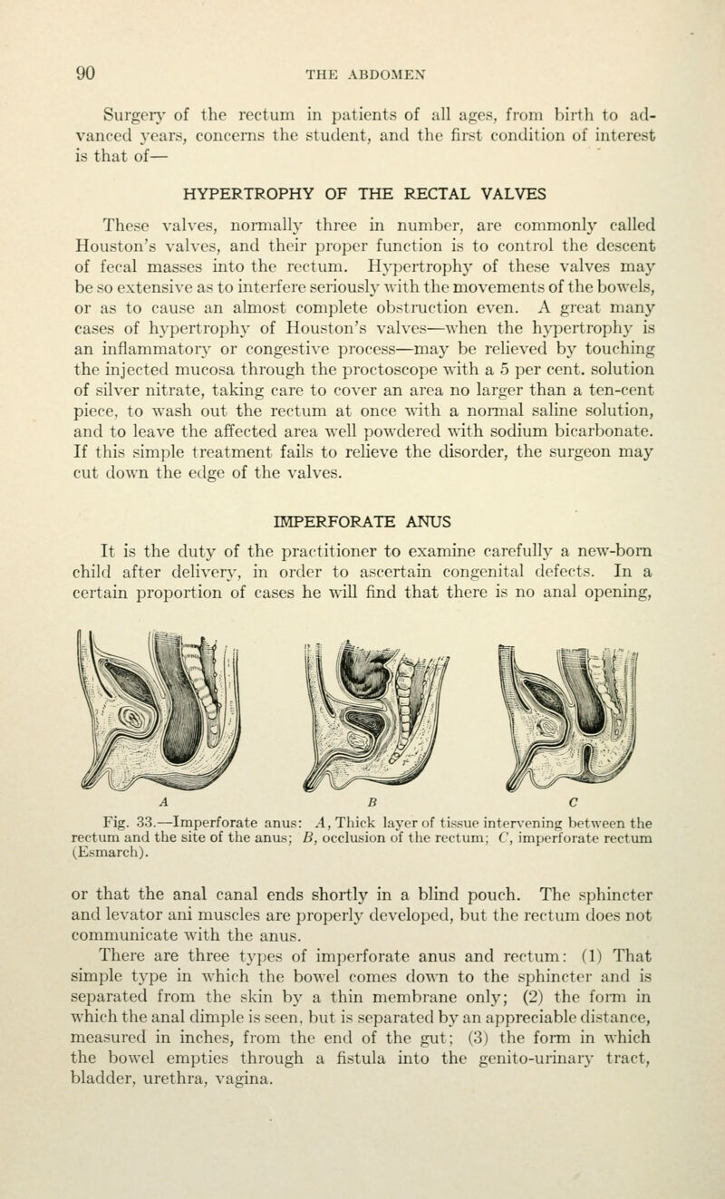 Surgery of the rectum in patients of all ages, from birth to ad- vanced years, concerns the student, and the first condition of interest is that of— HYPERTROPHY OF THE RECTAL VALVES These valves, normally three in number, are commonly called Houston's valves, and their proper function is to control the descent of fecal masses into the rectum. Hypertrophy of these valves may be so extensive as to interfere seriously with the movements of the bowels, or as to cause an almost complete obstioiction even. A great many cases of hypertrophy- of Houston's valves—when the h}-}Dertrophy is an inflammatory or congestive process—may be relieved by touching the injected mucosa through the proctoscope with a 5 per cent, solution of silver nitrate, taking care to cover an area no larger than a ten-cent piece, to wash out the rectum at once with a nonnal saline solution, and to leave the affected area well powdered with sodium bicarbonate. If this simple treatment fails to relieve the disorder, the surgeon may cut down the edge of the valves. IMPERFORATE ANUS It is the duty of the practitioner to examine carefully a new-bom child after delivery, in order to ascertain congenital defects. In a certain proportion of cases he will find that there is no anal opening. ABC Fig. 33.—Imperforate anus: .4, Thick layer of tissue inter\'ening between the rectum and the site of the anus; B, occlusion of the rectum; C, imperforate rectum (Esmarch). or that the anal canal ends shortly in a blind pouch. The sphincter and levator ani muscles are properly developed, but the rectum does not communicate with the anus. There are three types of imperforate anus and rectum: (1) That simple type in which the bowel comes down to the sphincter and is separated from the skin by a thin membrane only; (2) the form in which the anal dimple is seen, but is separated by an appreciable distance, measured in inches, from the end of the gut; (3) the form in which the bowel empties through a fistula into the genito-urinary tract, bladder, urethra, vagina.