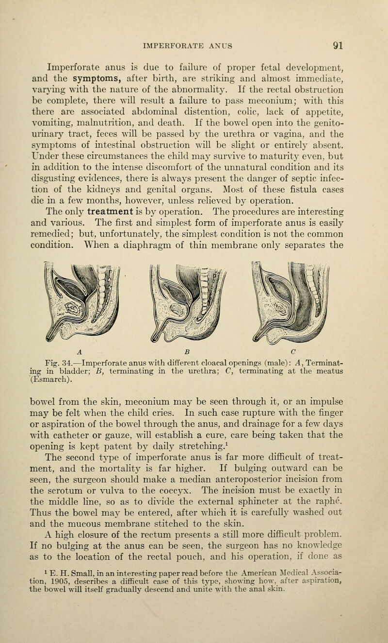 Imperforate anus is clue to failure of proper fetal development, and the symptoms, after birth, are striking and almost immediate, varying with the nature of the abnormality. If the rectal obstruction be complete, there wiU result a failure to pass meconium; with this there are associated abdominal distention, colic, lack of appetite, vomiting, malnutrition, and death. If the bowel open into the genito- urinaiy tract, feces will be passed by the urethra or vagina, and the symptoms of intestinal obstruction will be slight or entirely absent. Under these circumstances the child may survive to maturity even, but in addition to the intense discomfort of the unnatural condition and its disgusting evidences, there is always present the danger of septic infec- tion of the kidneys and genital organs. Most of these fistula cases die in a few months, however, unless relieved by operation. The only treatment is by operation. The procedures are interesting and various. The first and simplest form of imperforate anus is easily remedied; but, unfortunately, the simplest condition is not the common condition. When a diaphragm of thin membrane only separates the A B c Fig. 34.—Imperforate anus T\-ith different cloacal openings (male): A, Terminat- ing in bladder; B, terminating in the urethra; C, terminating at the meatus (Esmarch). bowel from the skin, meconium may be seen through it, or an impulse may be felt when the child cries. In such case rupture with the finger or aspiration of the bowel through the anus, and drainage for a few days with catheter or gauze, will establish a cure, care being taken that the opening is kept patent by daily stretching.^ The second type of imperforate anus is far more difficult of treat- ment, and the mortality is far higher. If bulging outward can be seen, the surgeon should make a median anteroposterior incision from the scrotum or vulva to the coccyx. The incision must be exactly in the middle line, so as to divide the external sphincter at the raphe. Thus the bowel may be entered, after which it is carefully washed out and the mucous membrane stitched to the skin. A high closure of the rectum presents a still more difficult problem. If no bulging at the anus can be seen, the surgeon has no knowledge as to the location of the rectal pouch, and his operation, if done as ^ E. H. Small, in an interesting paper read before the American Medical Associa- tion, 1905, describes a difficult case of this tj^e, showing how, after aspiration, the bowel will itself gradually descend and unite with the anal skin.