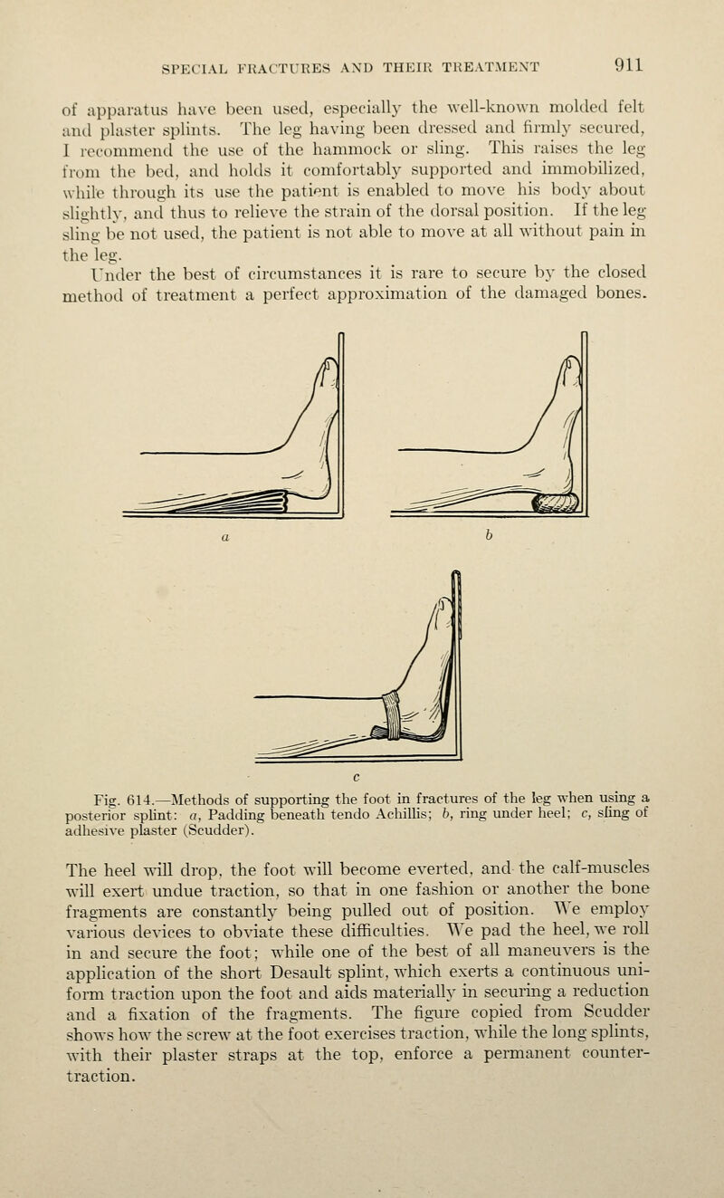 of apparatus have been used, especially the well-known molded felt and plaster splmts. The leg having been dressed and firmly secured, 1 recommend the use of the hammock or sling. This raises the leg from the bed, and holds it comfortably supported and immobilized, while through its use the patient is enabled to move his body about slightly, and thus to relieve the strain of the dorsal position. If the leg sling be not used, the patient is not able to move at all without pain in the leg. Under the best of circumstances it is rare to secure by the closed method of treatment a perfect approximation of the damaged bones. Fig. 614.—Methods of supporting the foot in fractures of the leg when using a posterior spUnt: a, Padding beneath tendo AchiUis; b, ring under heel; c, sling of adhesive plaster (Scudder). The heel will drop, the foot will become everted, and the calf-muscles will exert undue traction, so that in one fashion or another the bone fragments are constantly being pulled out of position. We employ various devices to obviate these difficulties. We pad the heel, we roll in and secure the foot; while one of the best of all maneuvers is the application of the short Desault splint, which exerts a continuous uni- form traction upon the foot and aids materially in securing a reduction and a fixation of the fragments. The figure copied from Scudder shows how the screw at the foot exercises traction, while the long splints, with their plaster straps at the top, enforce a permanent counter- traction.